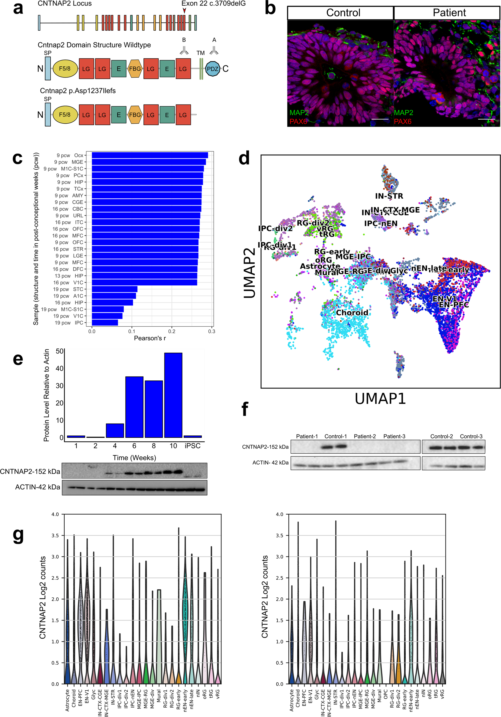 Cortical Overgrowth In A Preclinical Forebrain Organoid Model Of Cntnap2 Associated Autism Spectrum Disorder Nature Communications