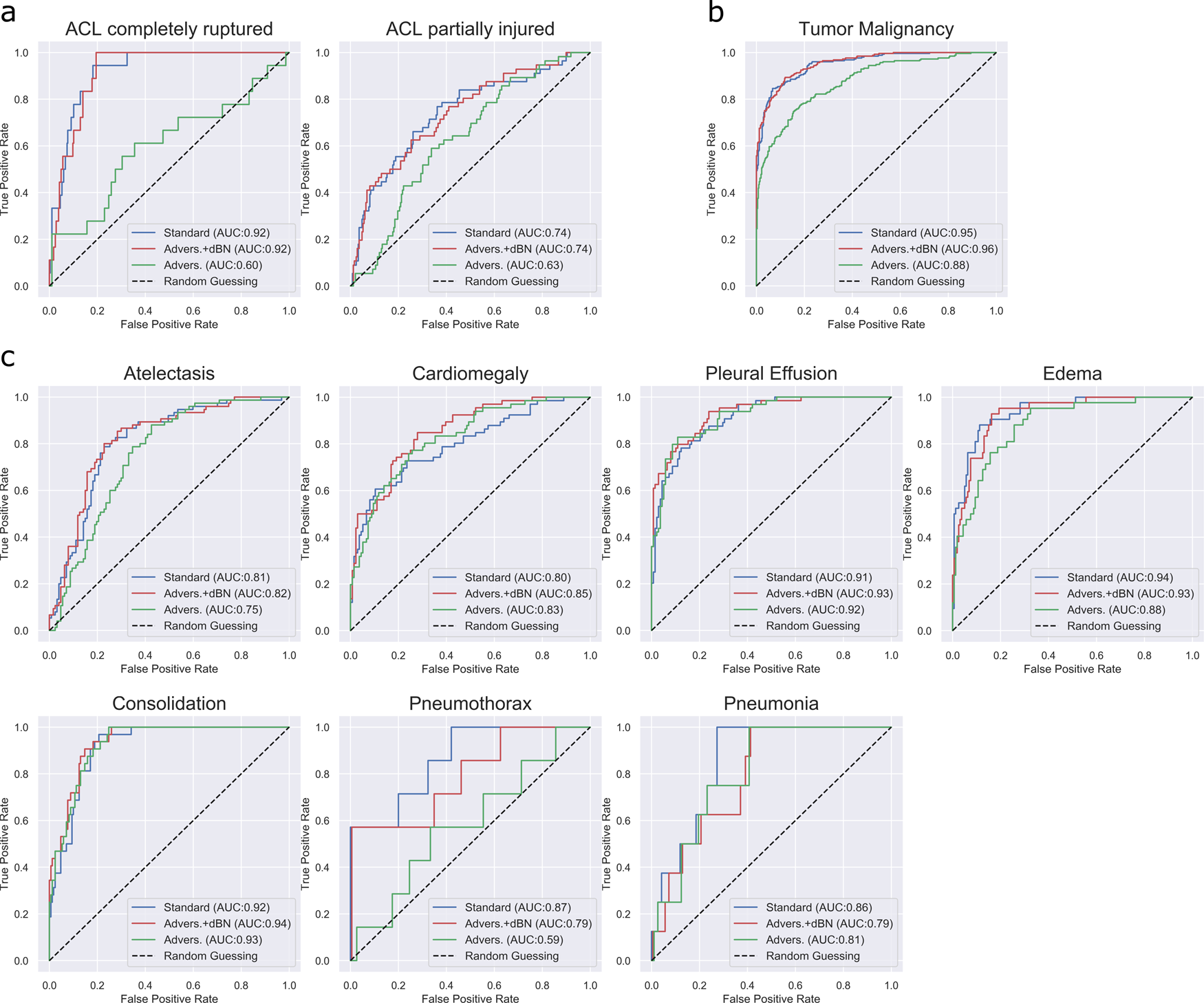 Fig. 2: The usage of dual batch norm boosts the classification performance of neural networks.