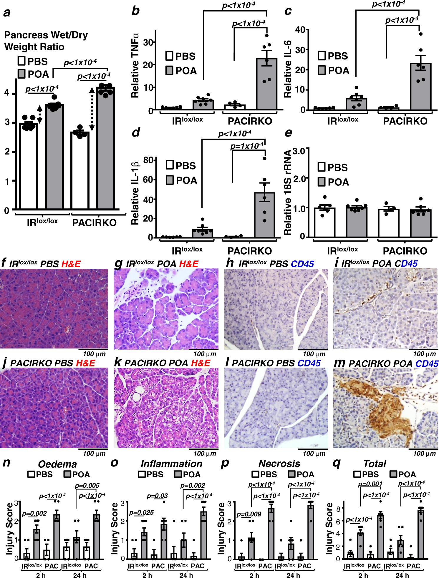 Fig. 4: POA/ethanol-induced pancreatitis was more severe in PACIRKO vs IRlox/lox mice.