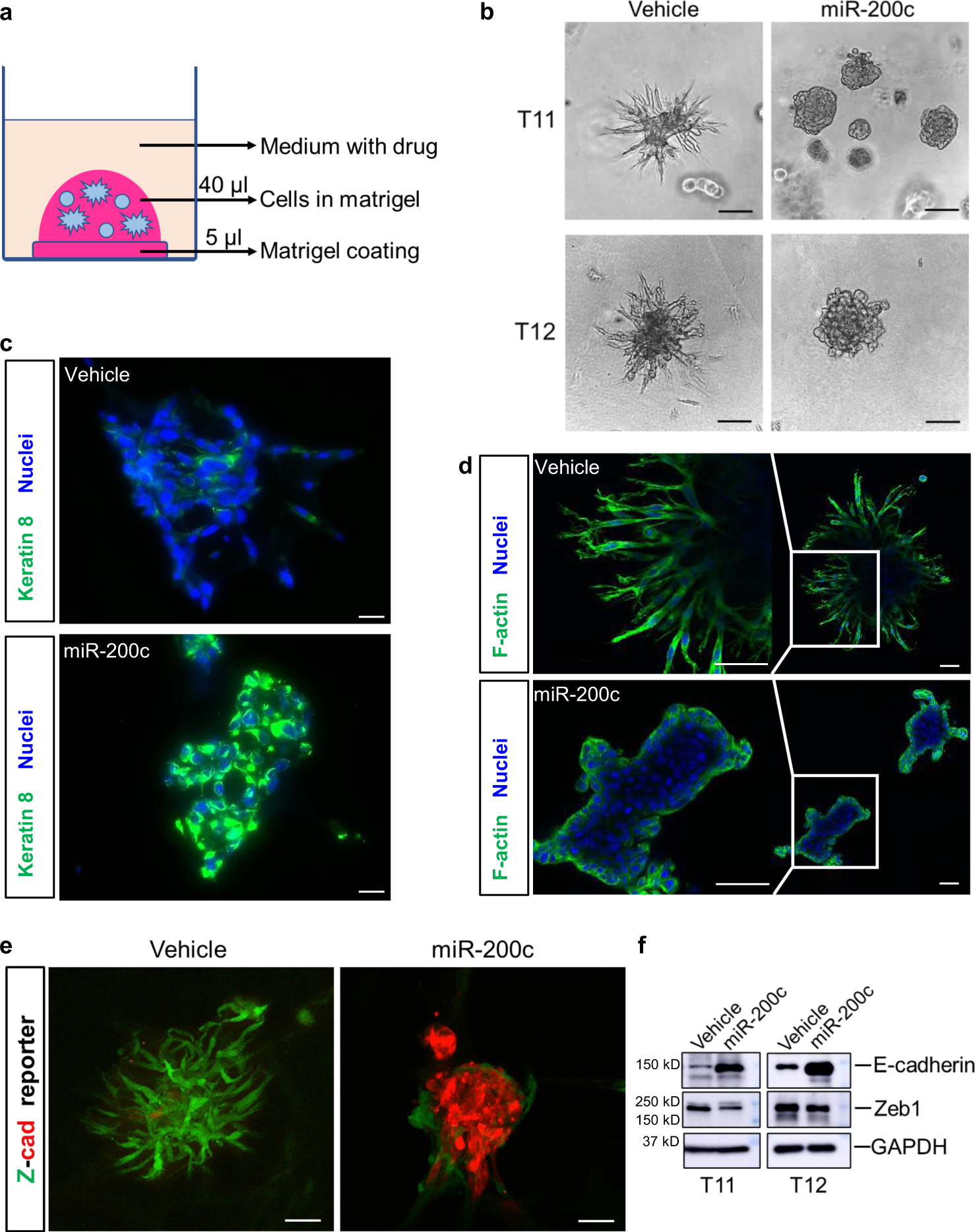 Morphological Screening Of Mesenchymal Mammary Tumor Organoids To Identify Drugs That Reverse Epithelial Mesenchymal Transition Nature Communications Morphological Screening Of Mesenchymal Mammary Tumor Organoids To Identify Drugs That Reverse Epithelial Mesenchymal Transition Nature Communications