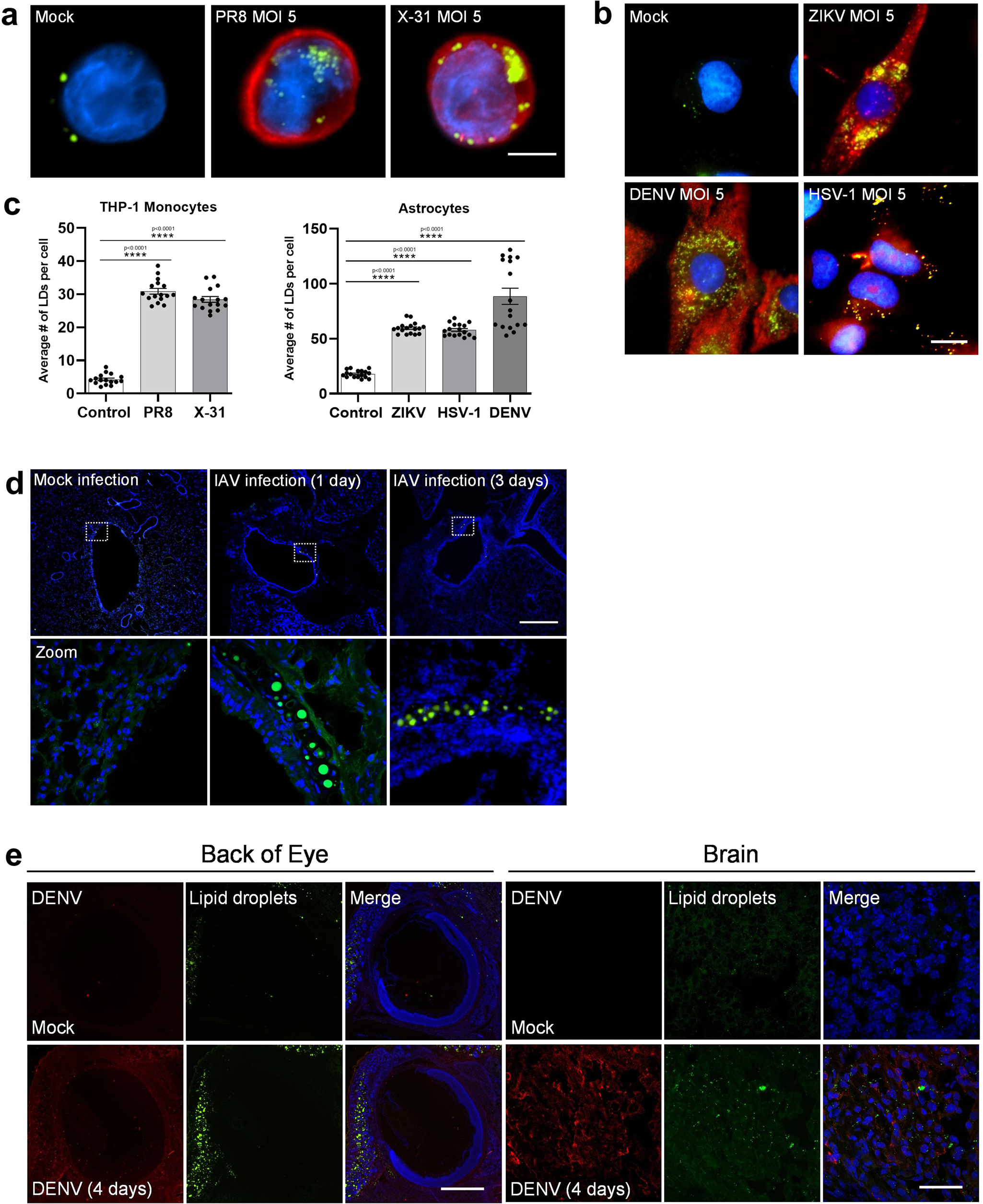 Intracellular lipid droplet accumulation occurs early following viral  infection and is required for an efficient interferon response | Nature  Communications