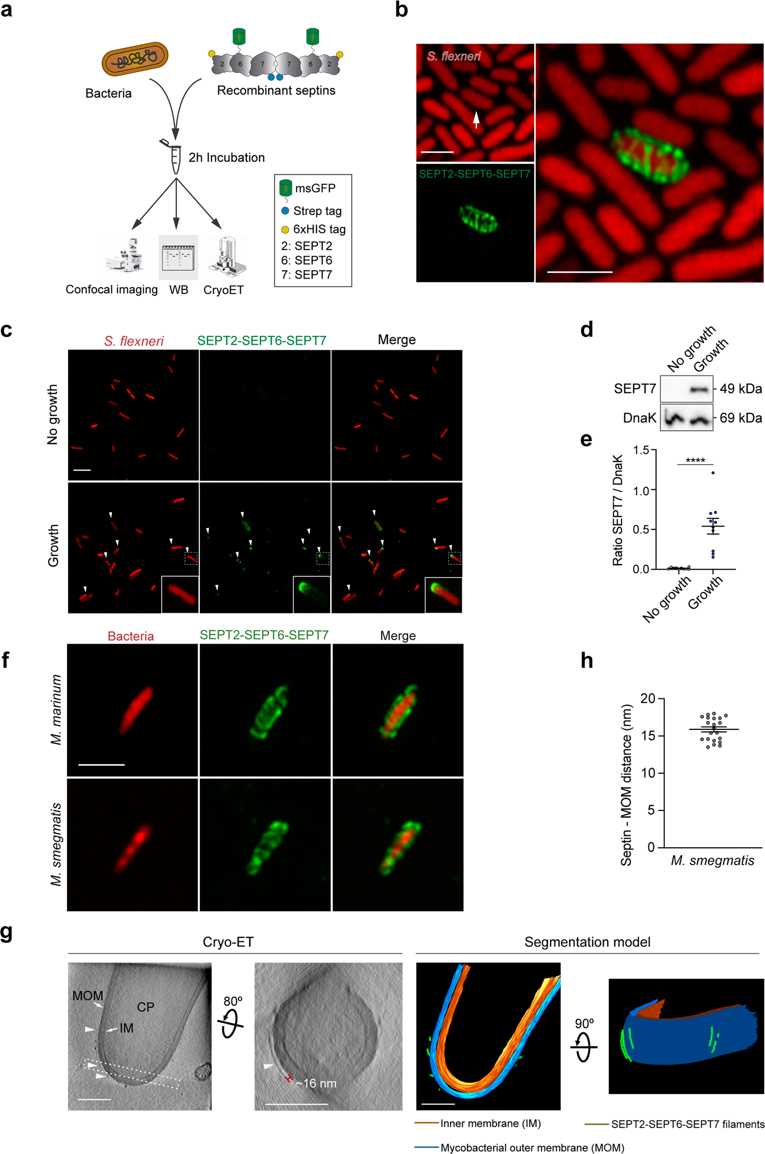 Fig. 1: Bacterial growth is essential for S. flexneri recognition by septins.