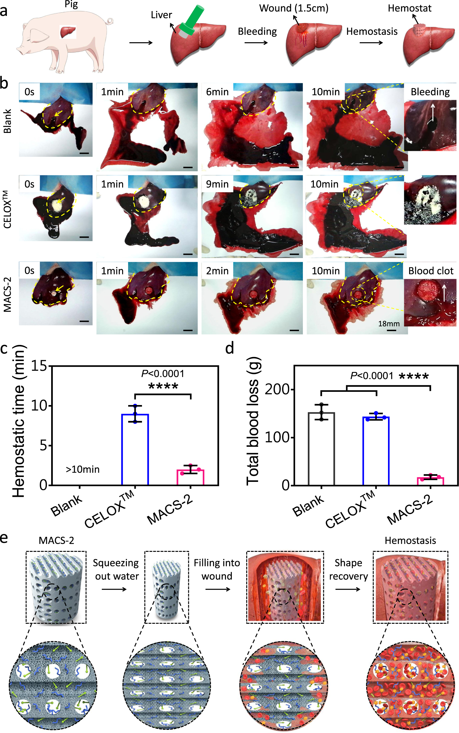 Fig. 7: Hemostasis in a lethal pig liver perforation wound model.