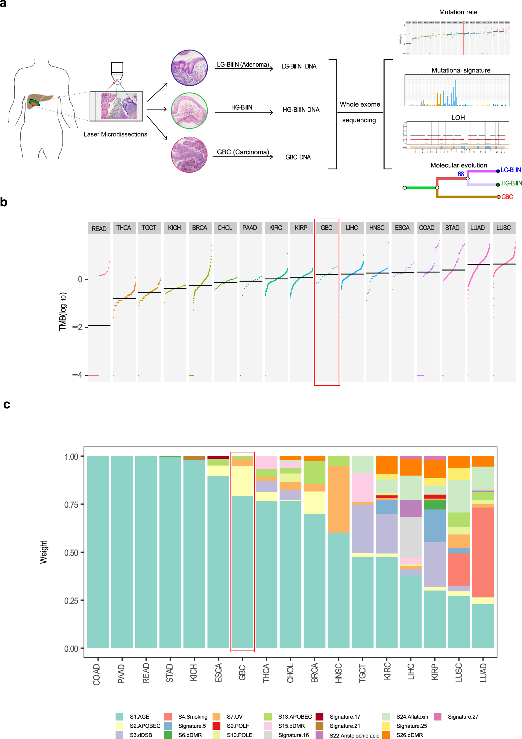 Fig. 1: Study overview and mutation characteristics of BilIN-related GBC.