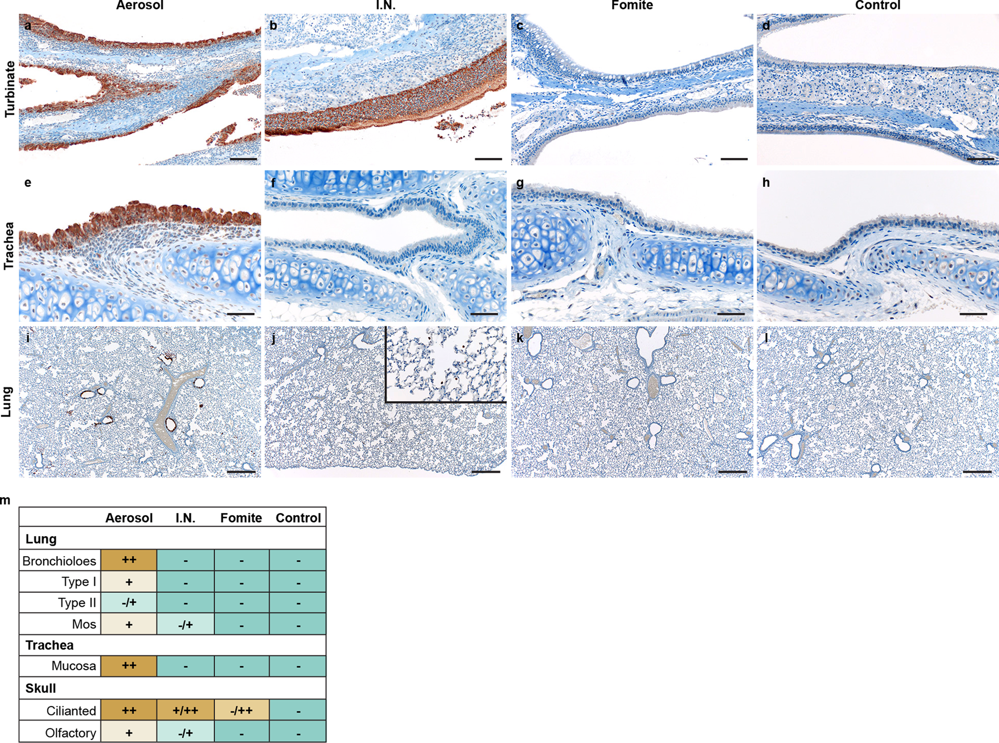 Fig. 2: Comparison of early replication of SARS-CoV-2 in respiratory tract.