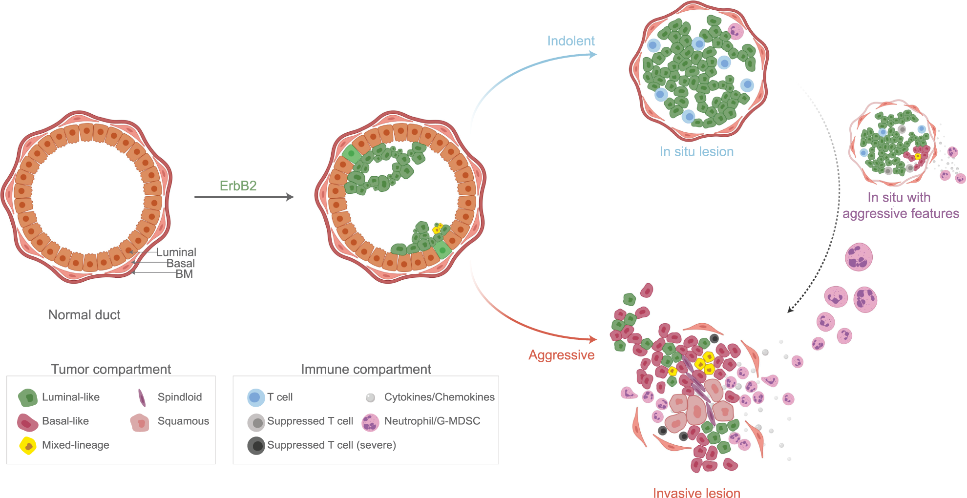 Fig. 8: Indolent and aggressive lesions exhibit divergent tumor-immune niches.