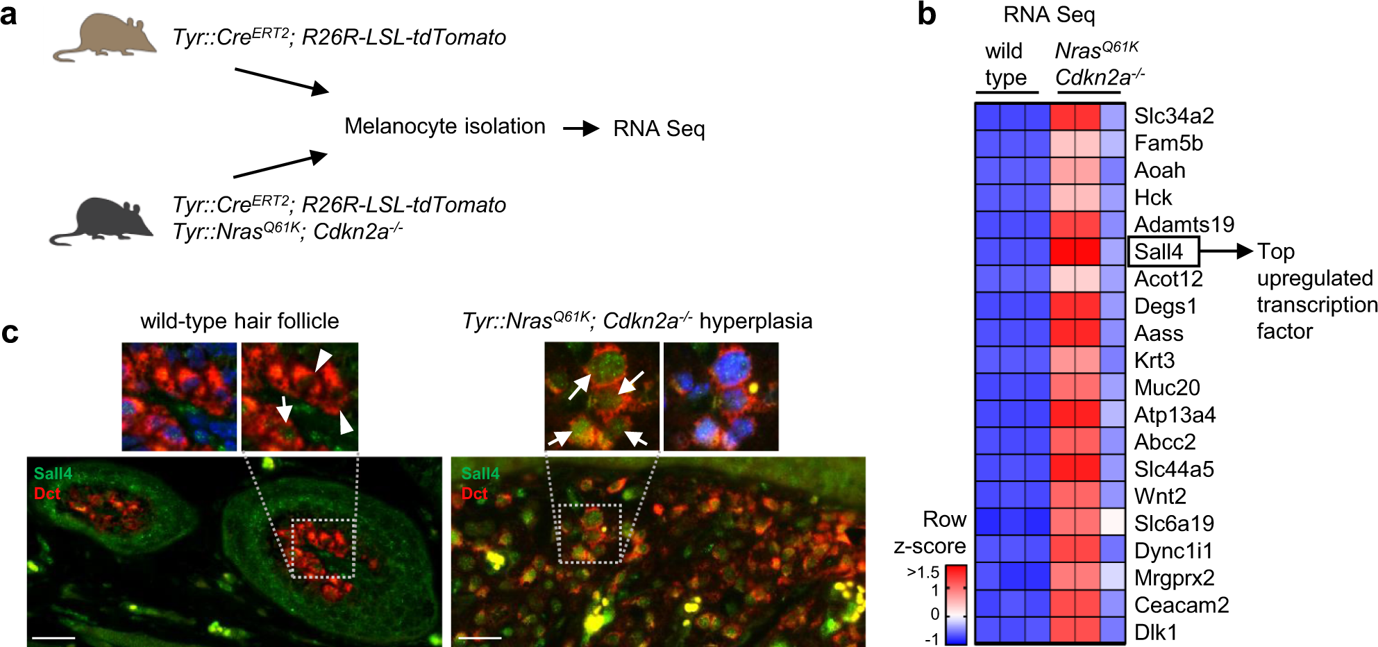 Epigenetic control of melanoma cell invasiveness by the stem cell factor  SALL4 | Nature Communications