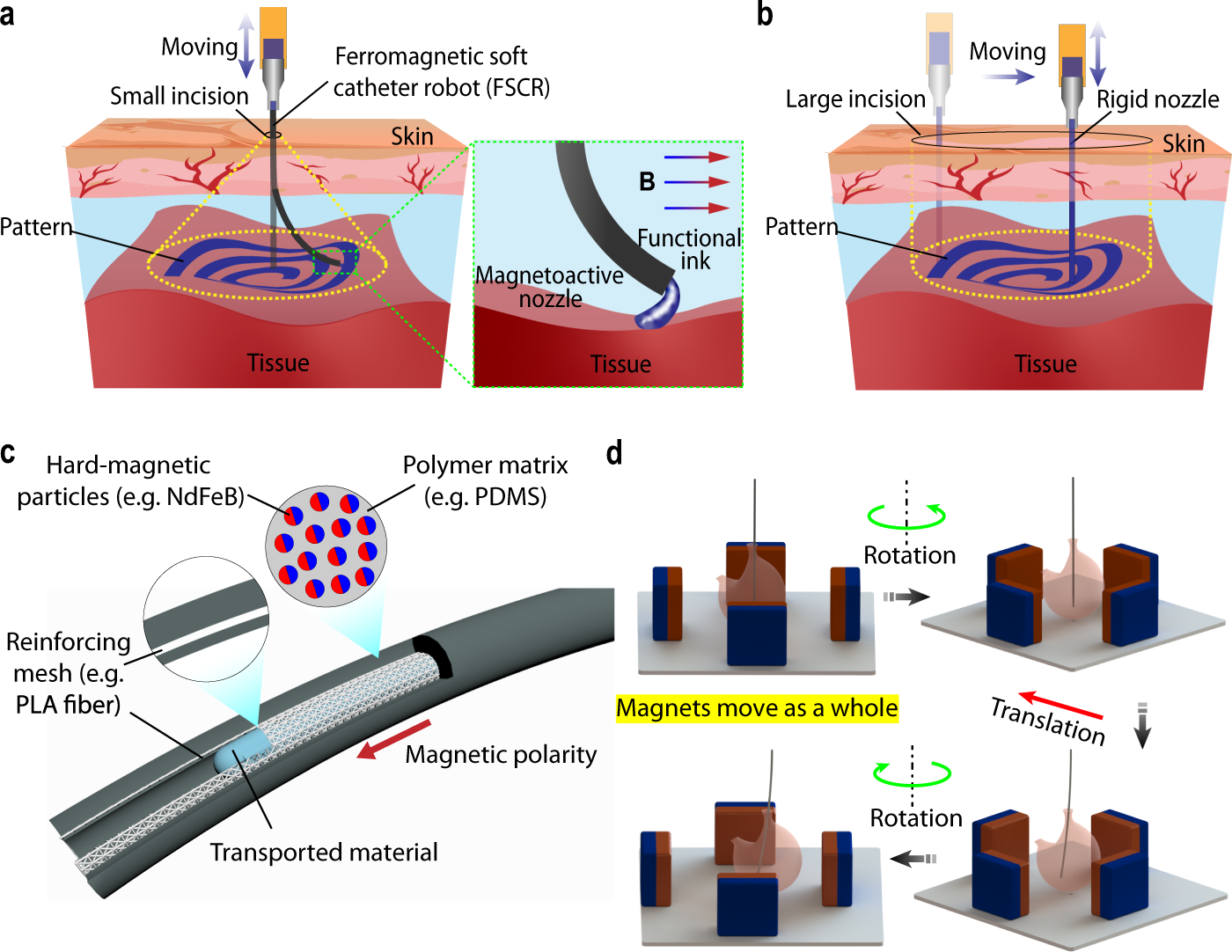 Ferromagnetic soft catheter robots for minimally invasive bioprinting |  Nature Communications