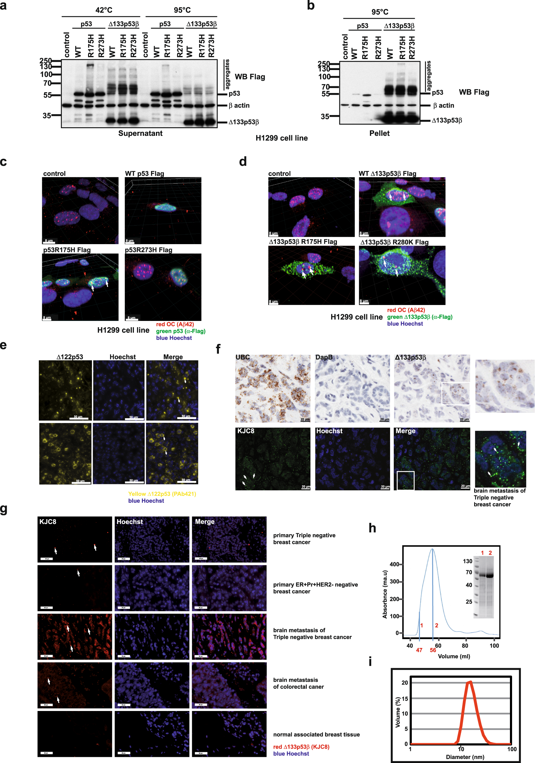 Fig. 1: Evaluation of the aggregate forming ability of p53 and Δ133p53β.