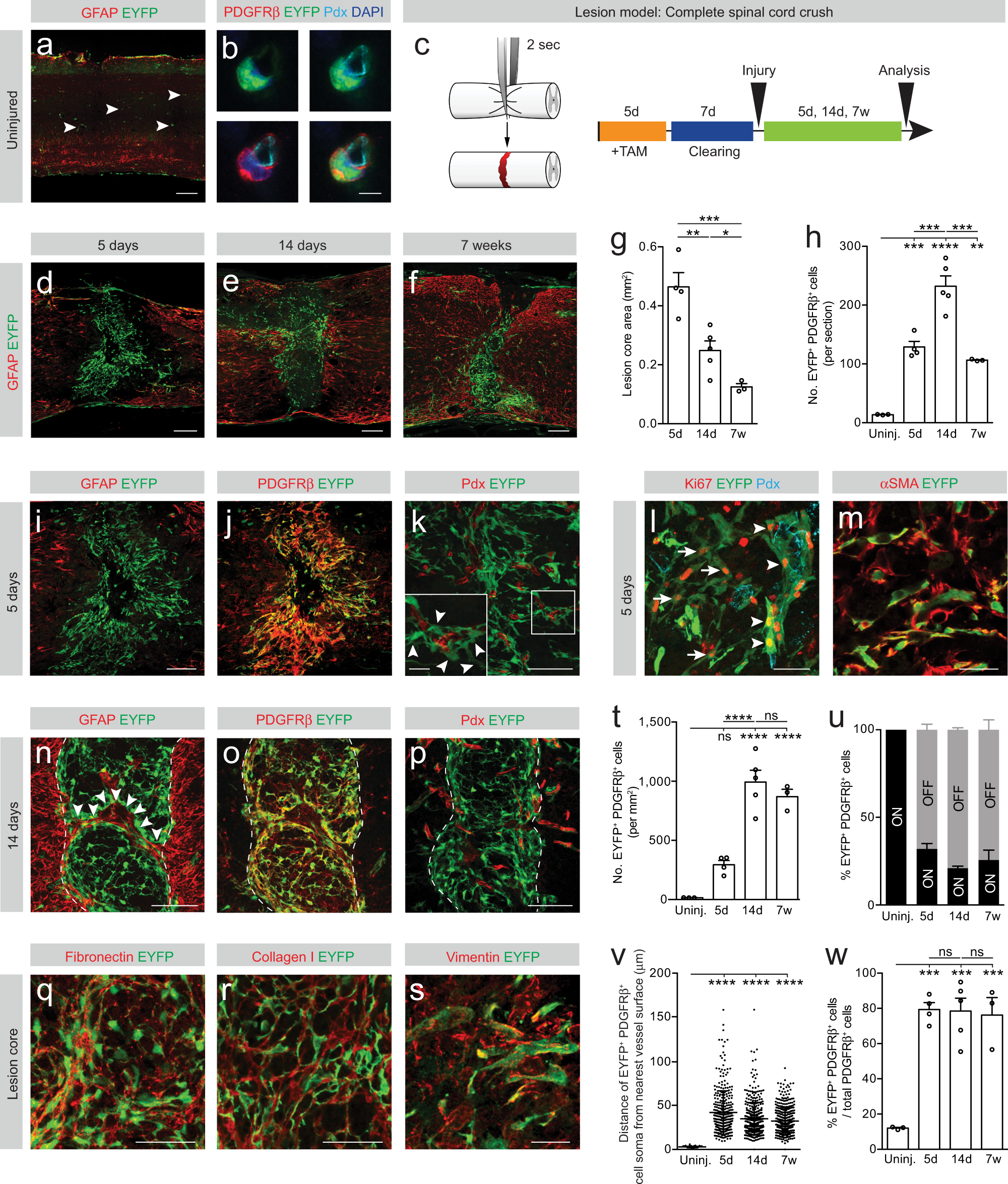 Fig. 1: Type A pericytes are the main source of stromal fibroblasts that form fibrotic scar tissue after non-penetrating spinal crush injury.