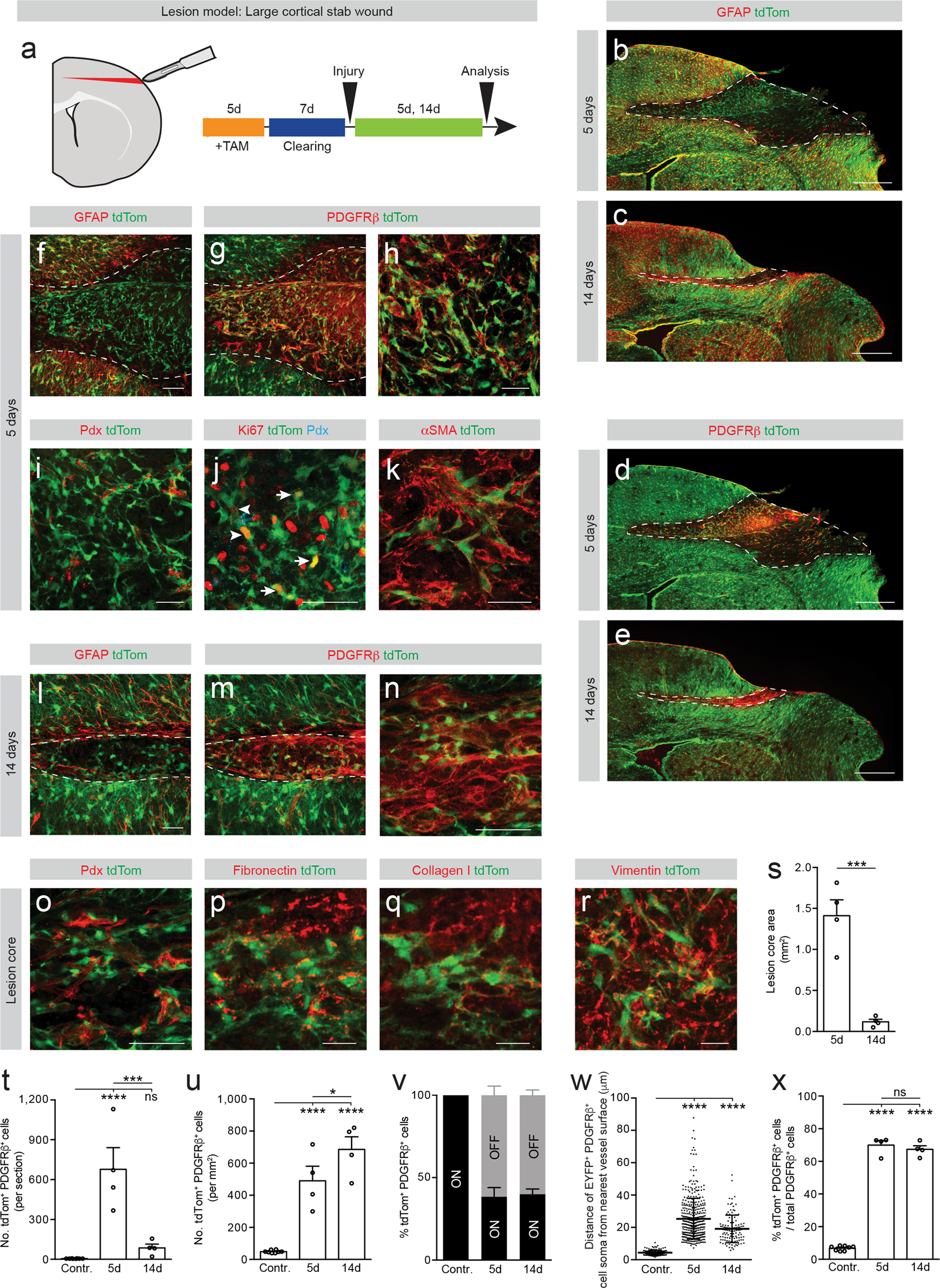 Fig. 3: Type A pericytes are the main source of stromal fibroblasts that form fibrotic scar tissue after large stab lesions restricted to the cerebral cortex.