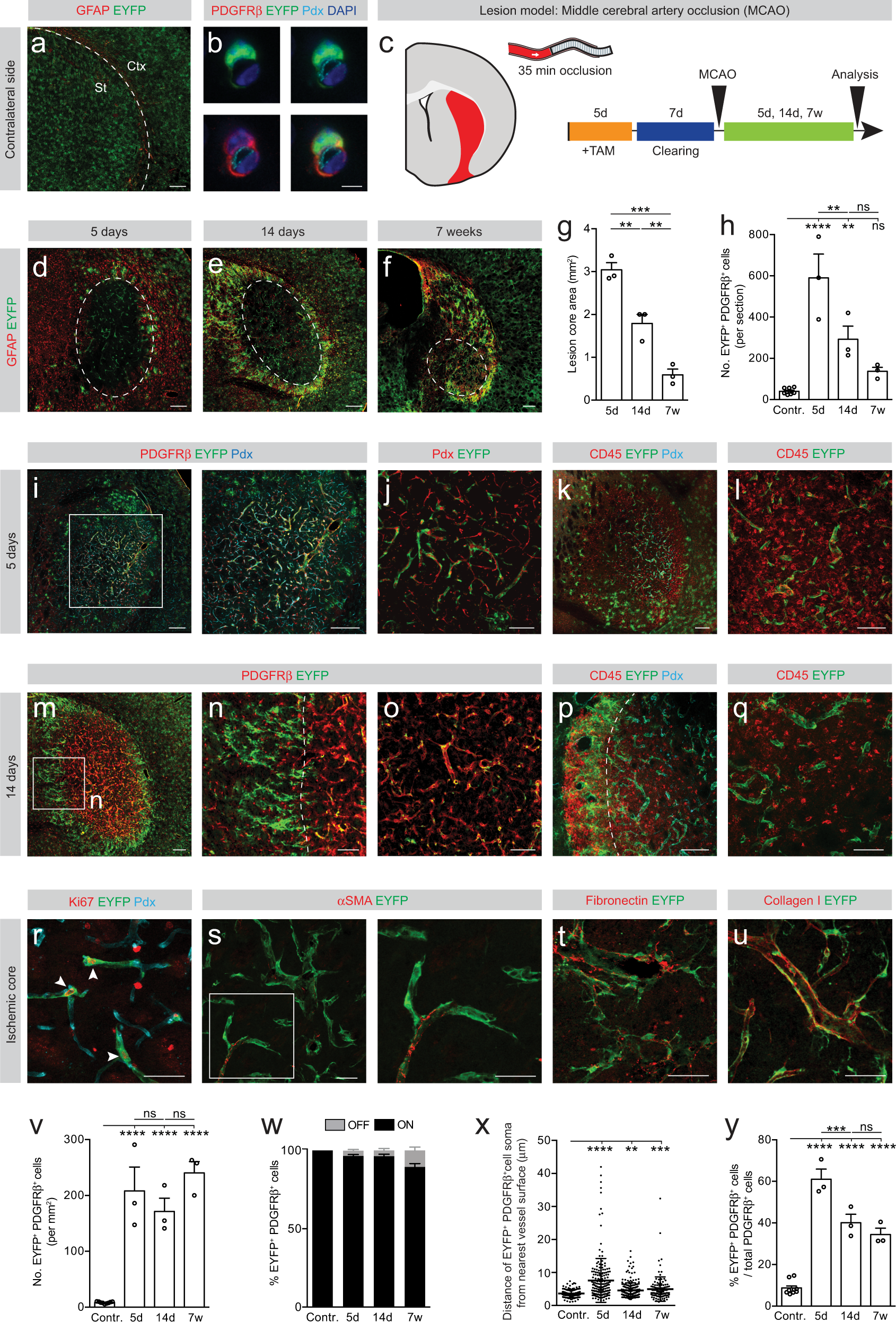 Fig. 5: Type A pericytes remain associated with the vascular wall following ischemic stroke confined to the striatum.