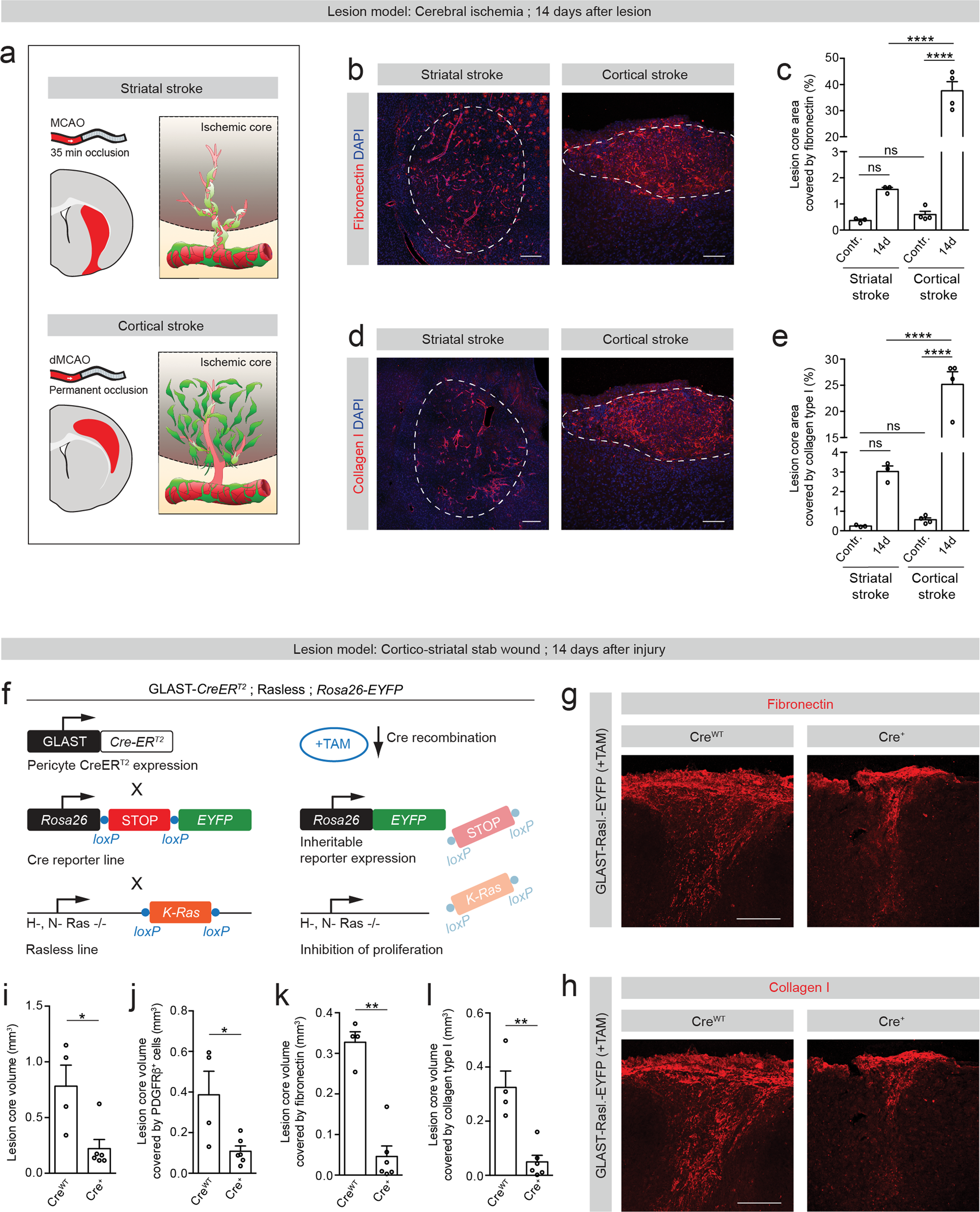 Fig. 8: Type A pericytes are required for the generation of fibrotic scar tissue and deposition of ECM after injury.