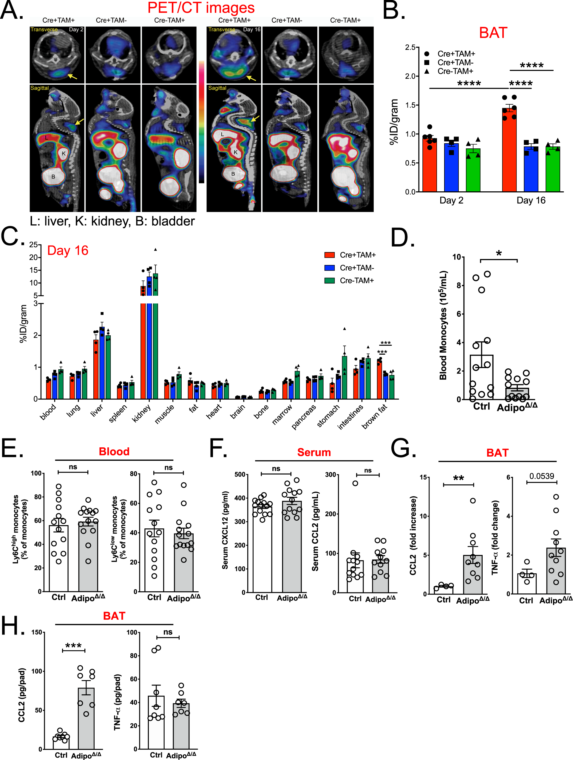 Fig. 3: Adipocyte ATGL deletion induces a specific recruitment of blood monocytes to the BAT.