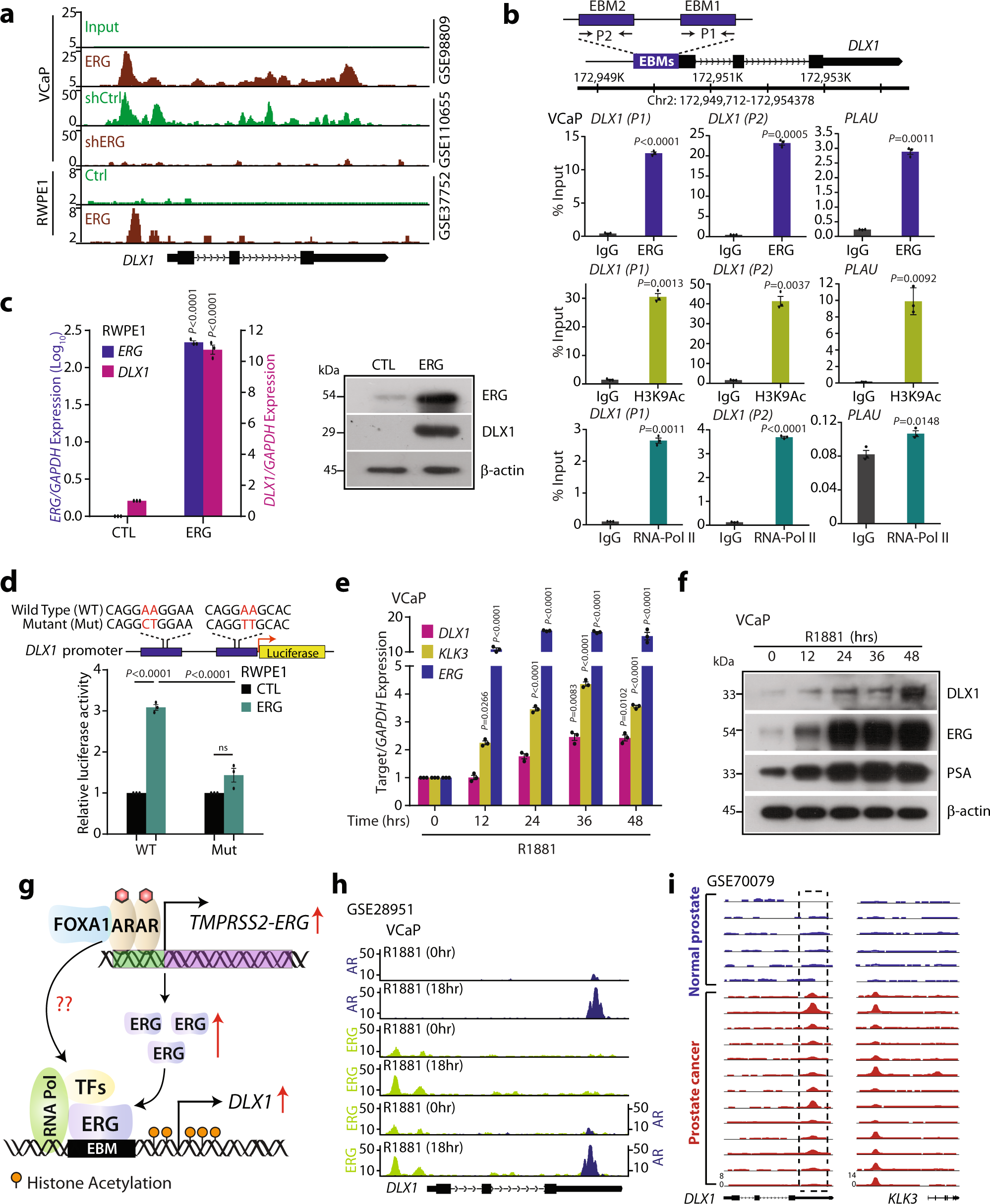 Fig. 5: DLX1 is a transcriptional target of ERG in TMPRSS2-ERG positive prostate cancer.