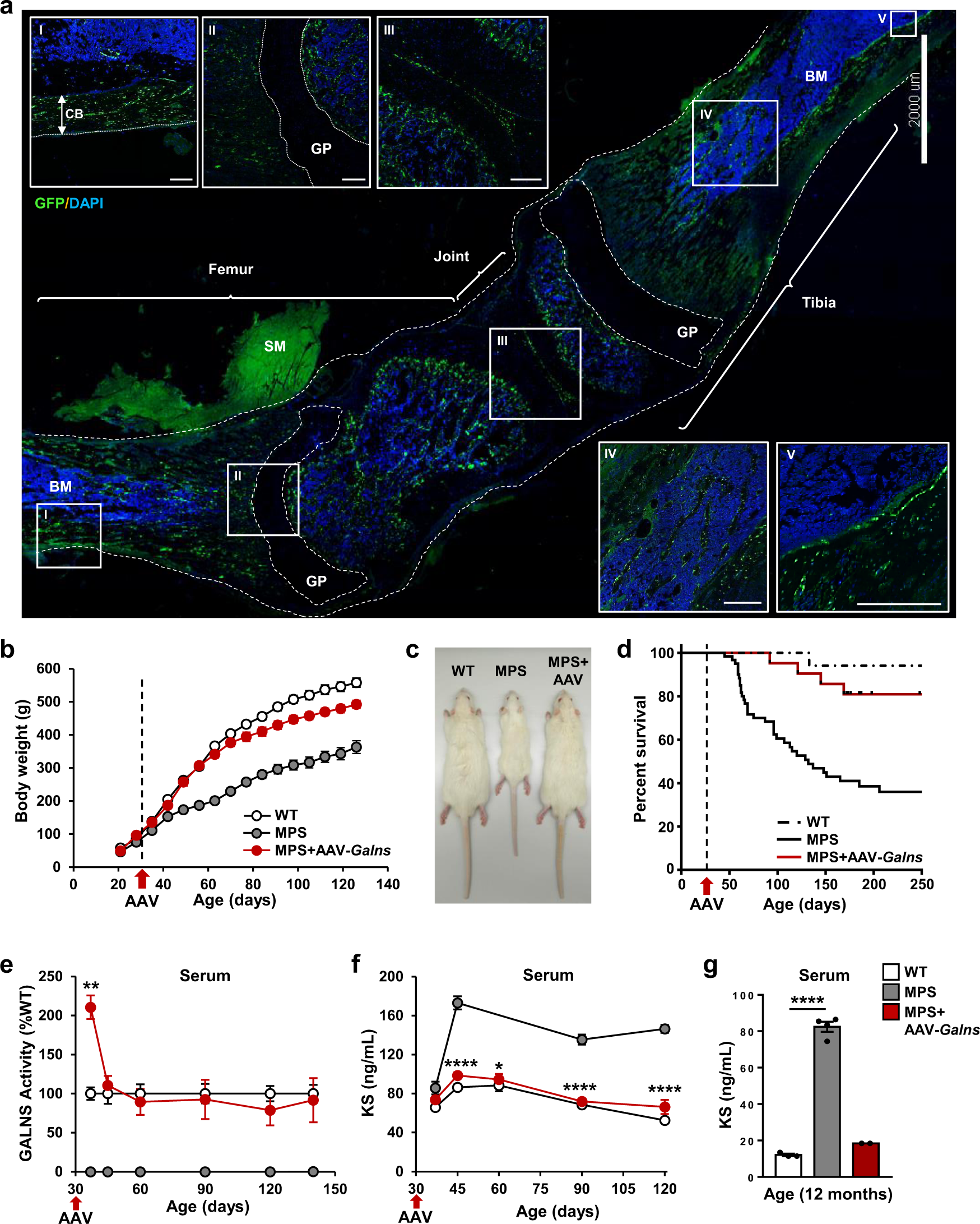 Fig. 1: AAV9-Galns treatment corrects MPSIVA pathology.