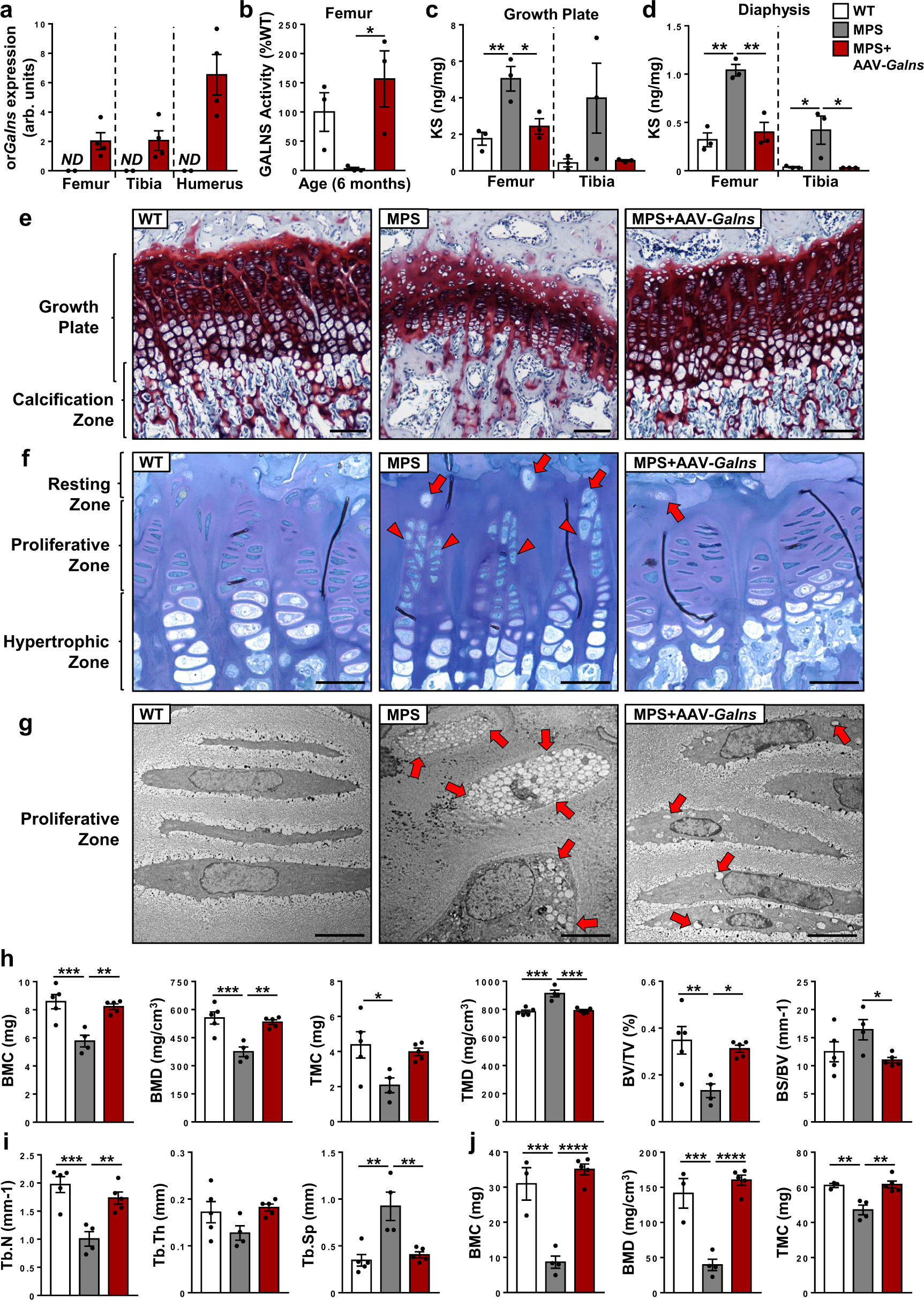 Fig. 3: Prevention of bone and growth cartilage alterations after AAV9-Galns administration.