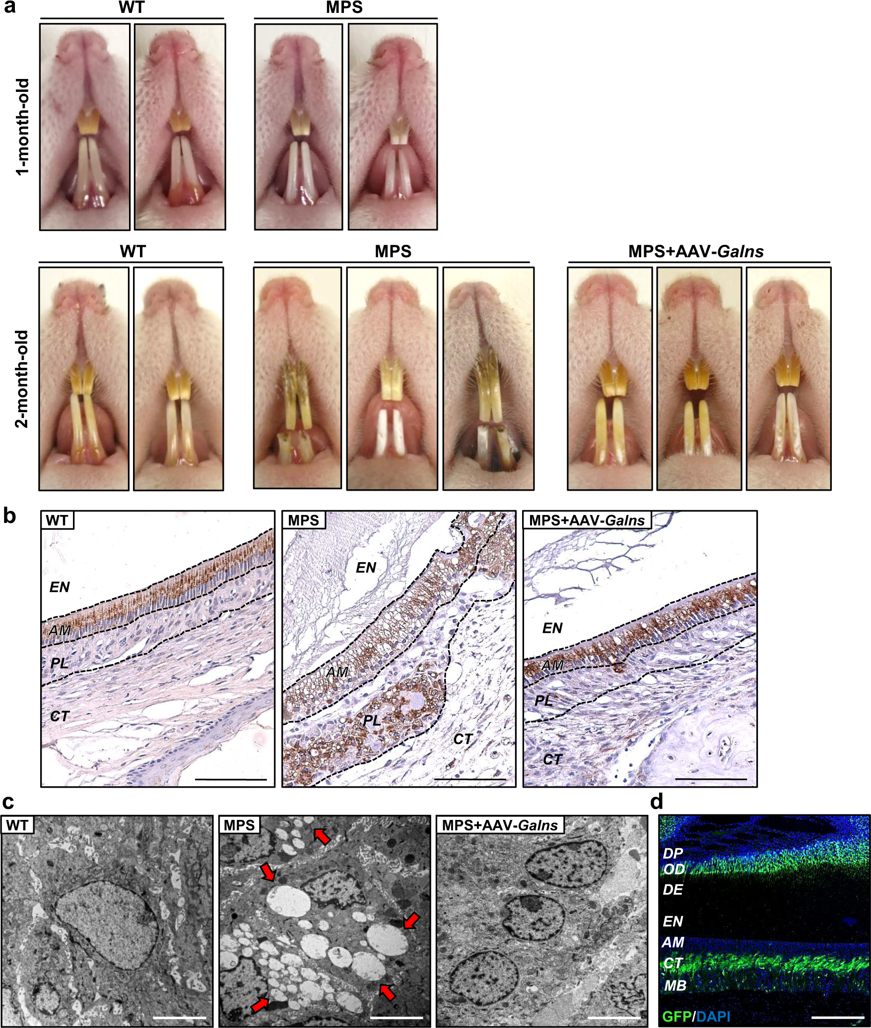 Fig. 4: Treatment with Galns-encoding vectors counteracts dental pathology.