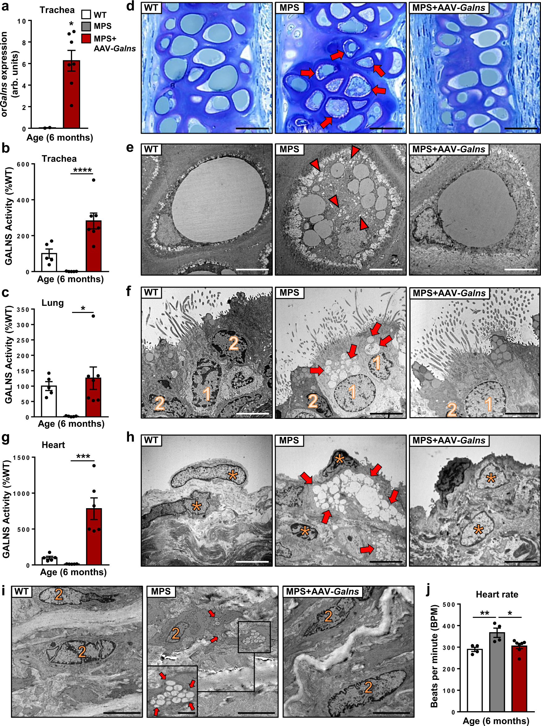 Fig. 6: Correction of tracheal and cardiac pathology in AAV9-Galns-treated MPSIVA rats.