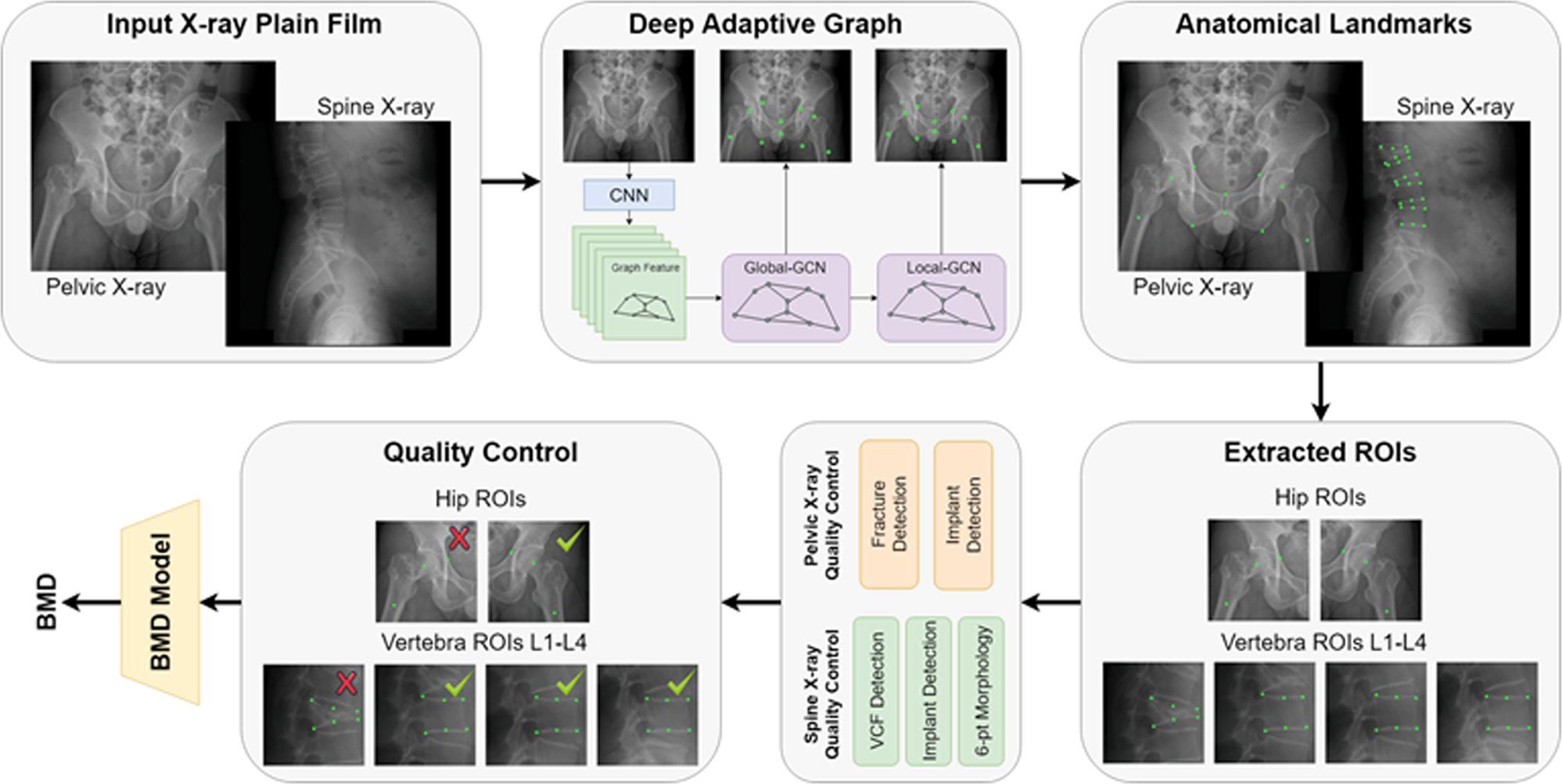 Comprehensive Guide to Bone Densitometry (DEXA) - Uses, Procedure, and  Results