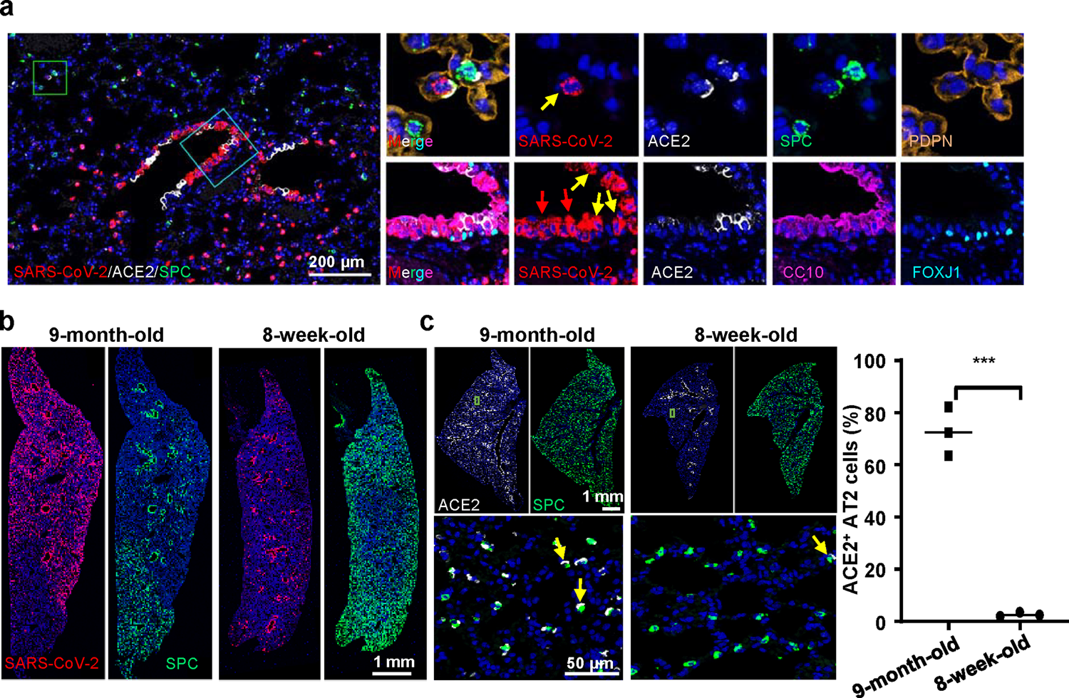 Fig. 2: Difference of MASCp36 cellular tropism in lungs from 9-month-old and 8-week-old mice.