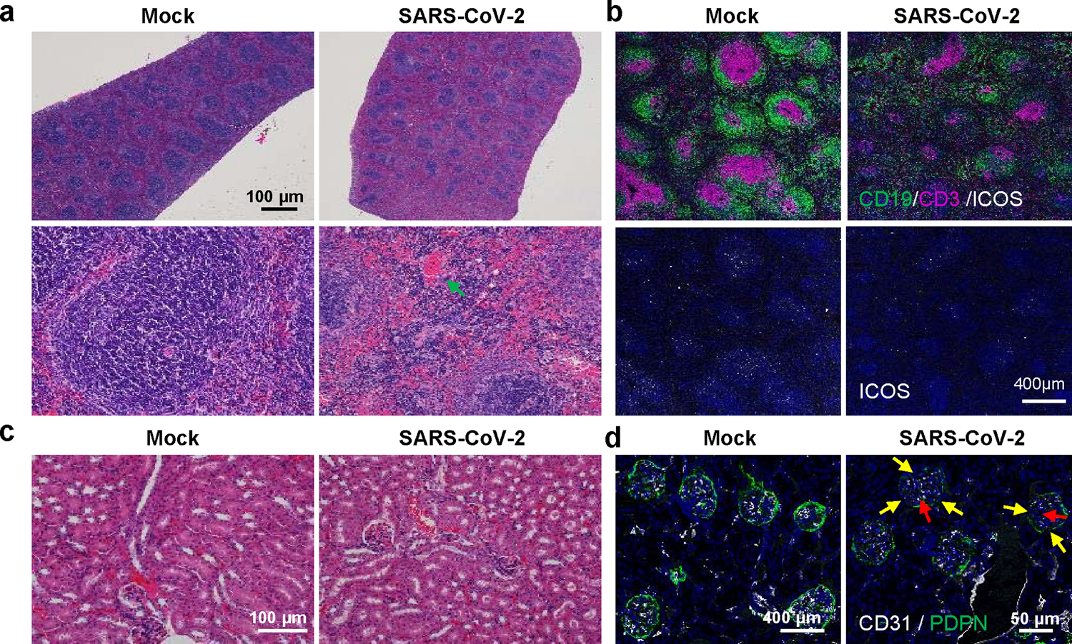 Fig. 4: Spleen and kidney injury during BALB/c mice infection with MASCp36.