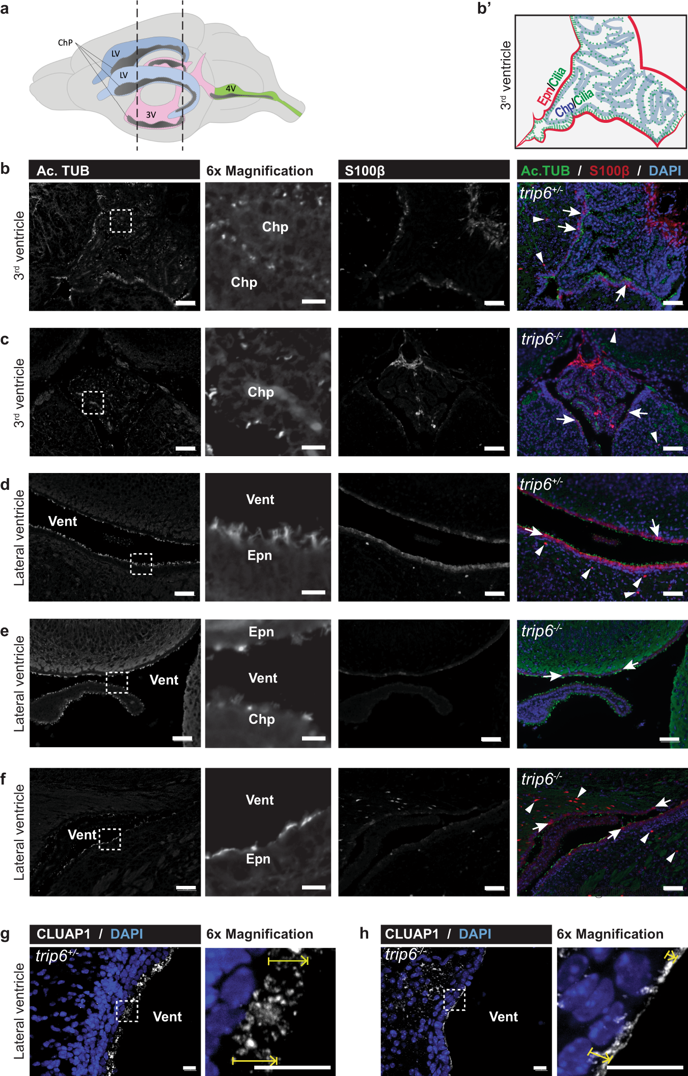 Fig. 4: Defective differentiation of ependyma and choroid plexus in trip6−/− mice.