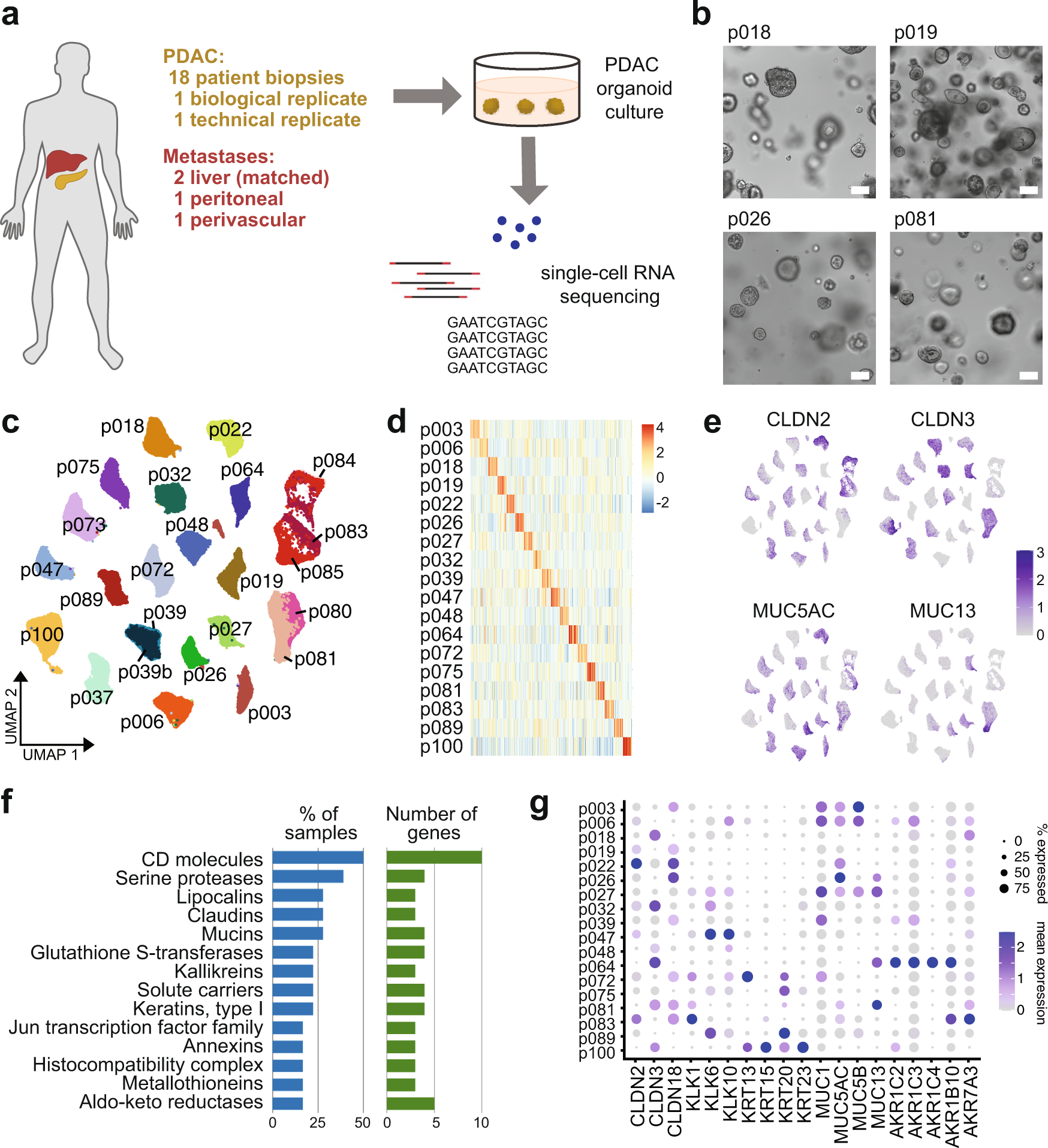 Single Cell Analysis Of Patient Derived Pdac Organoids Reveals Cell State Heterogeneity And A Conserved Developmental Hierarchy Nature Communications