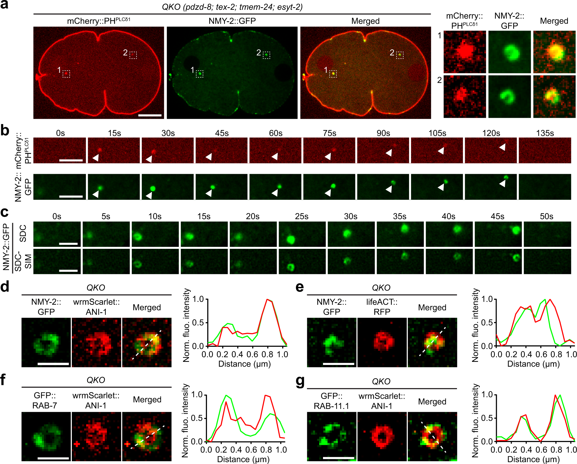 Fig. 2: Aberrant recruitment of proteins involved in actomyosin contraction to PI(4,5)P2-positive endosomal membranes in the absence of SMP proteins.
