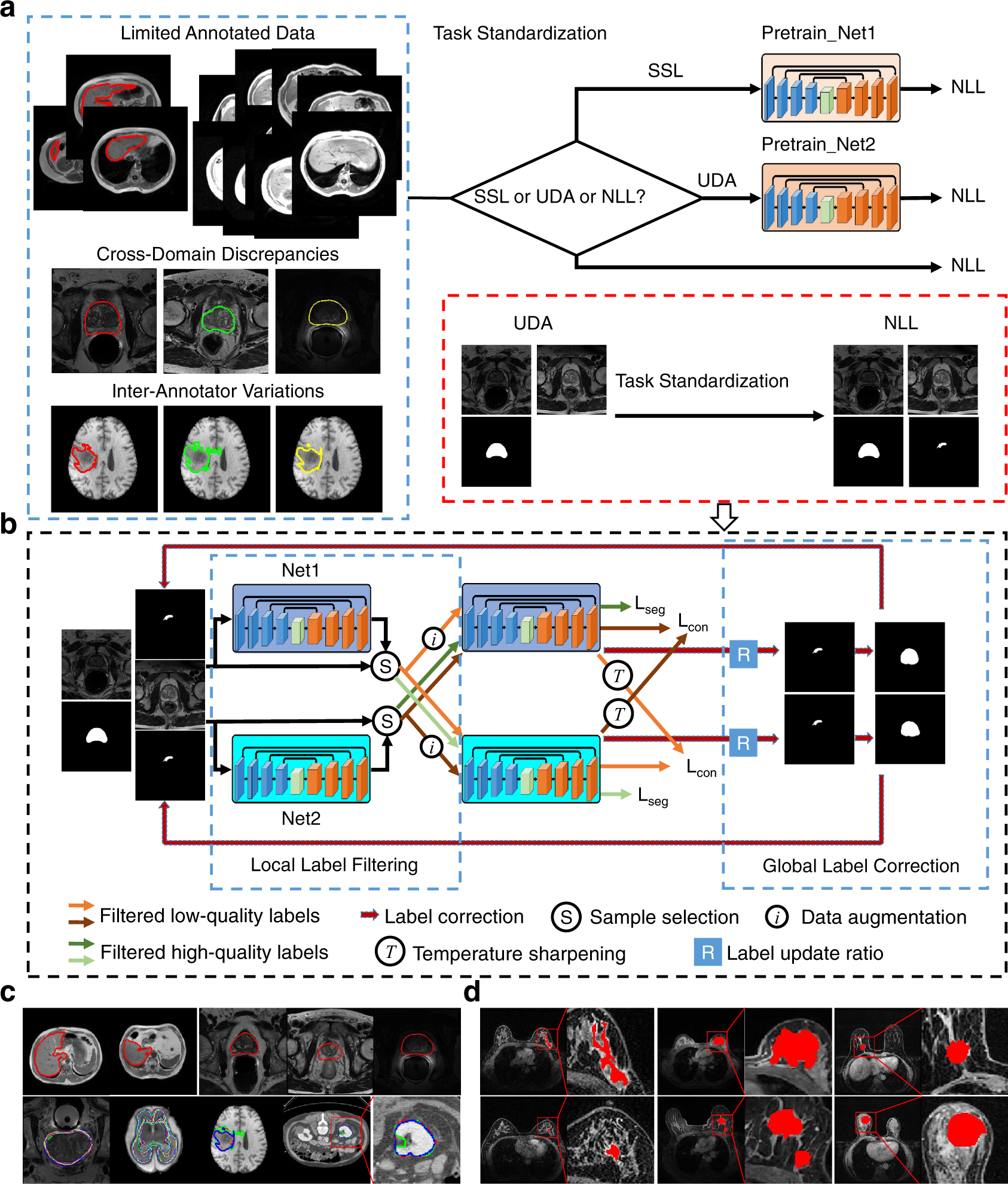 Annotation-Efficient Deep Learning For Automatic Medical Image Segmentation  | Nature Communications