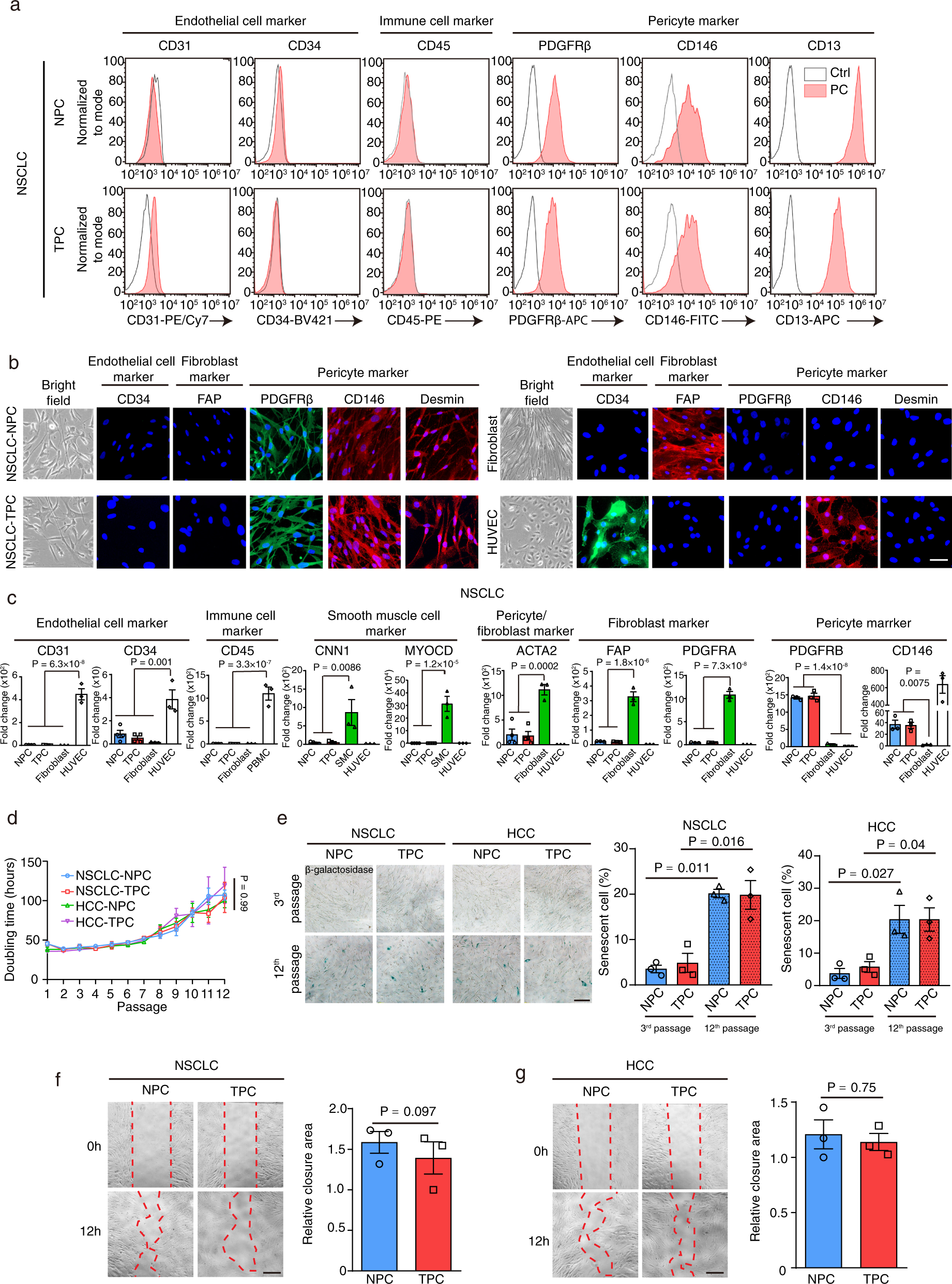 Fig. 2: Characterization of normal adjacent tissue derived pericytes and tumor-derived pericytes.