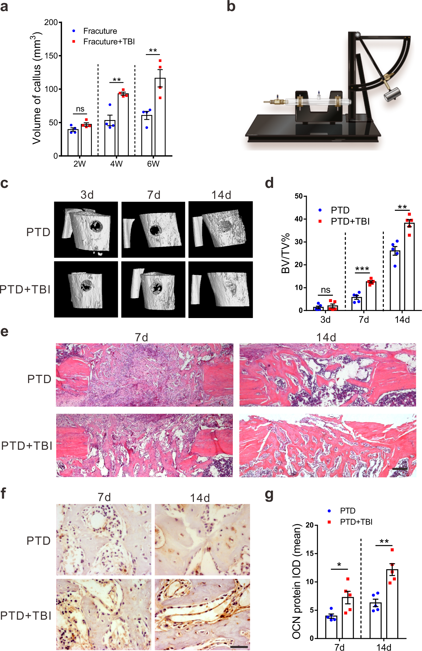 Damaged brain accelerates bone healing by releasing small extracellular vesicles that target osteoprogenitors Nature Communications