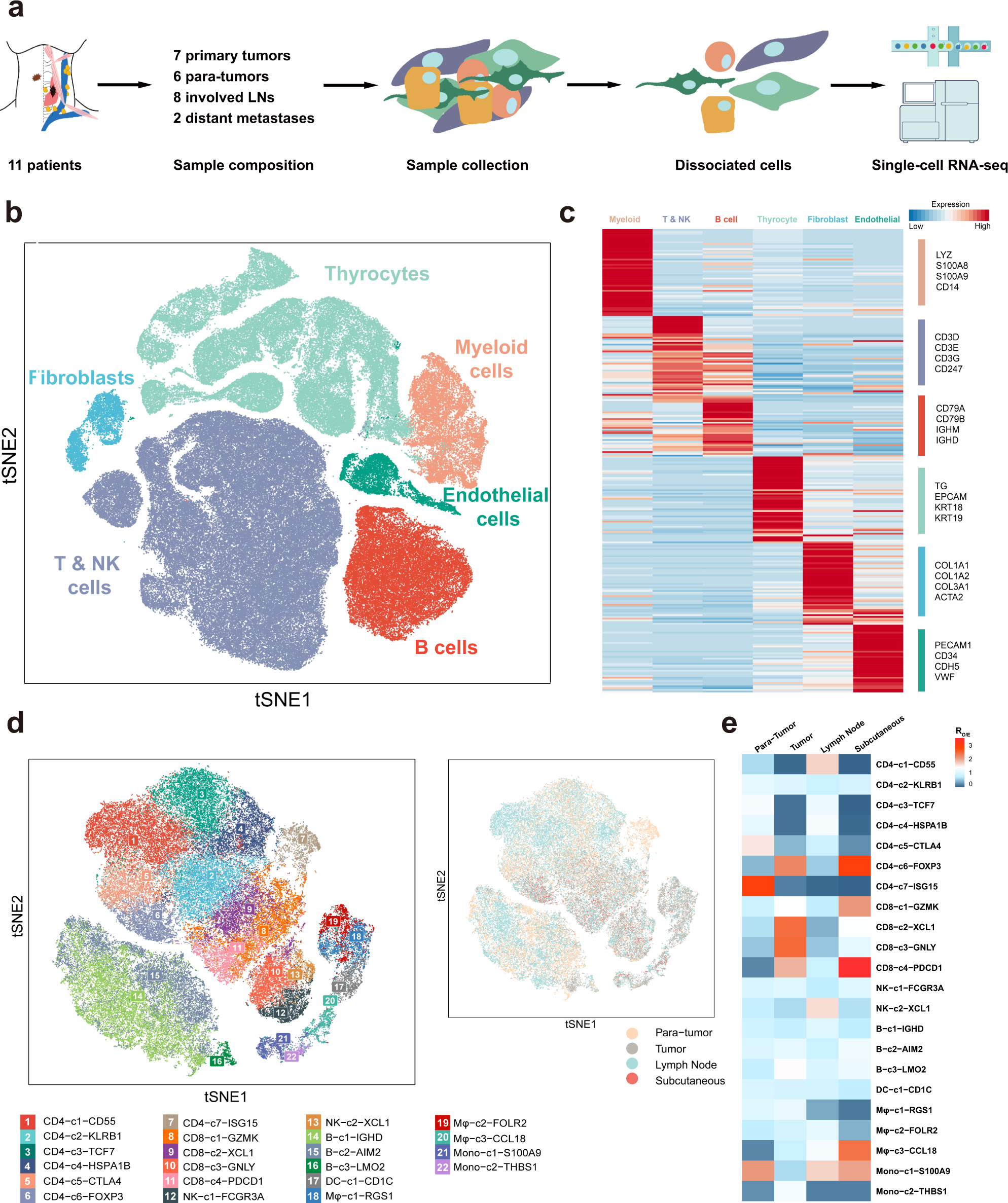 Single-cell transcriptomic analysis of the tumor ecosystems underlying  initiation and progression of papillary thyroid carcinoma | Nature  Communications