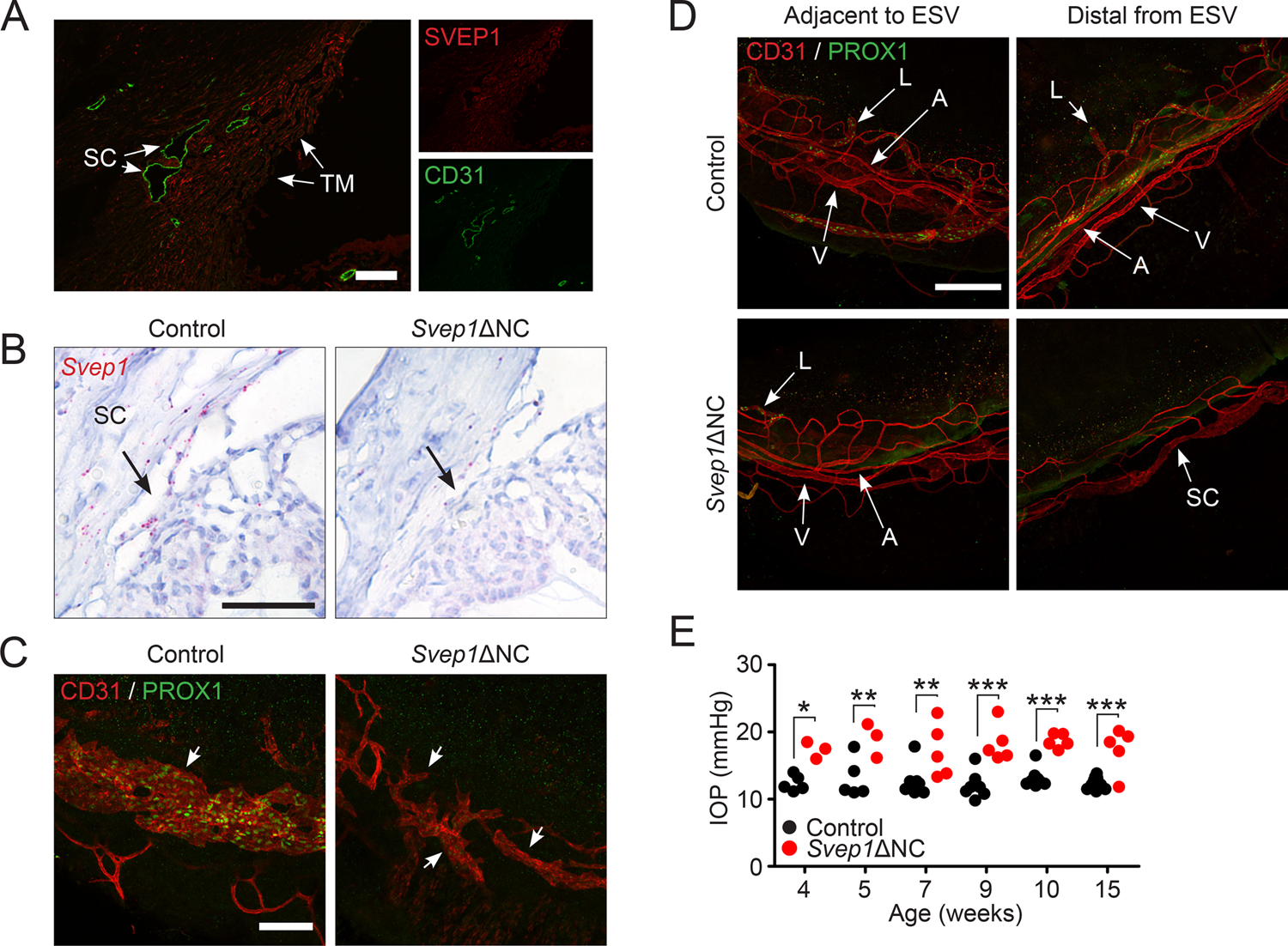 Fig. 4: Neural-crest derived SVEP1 is essential for Schlemm’s canal formation.