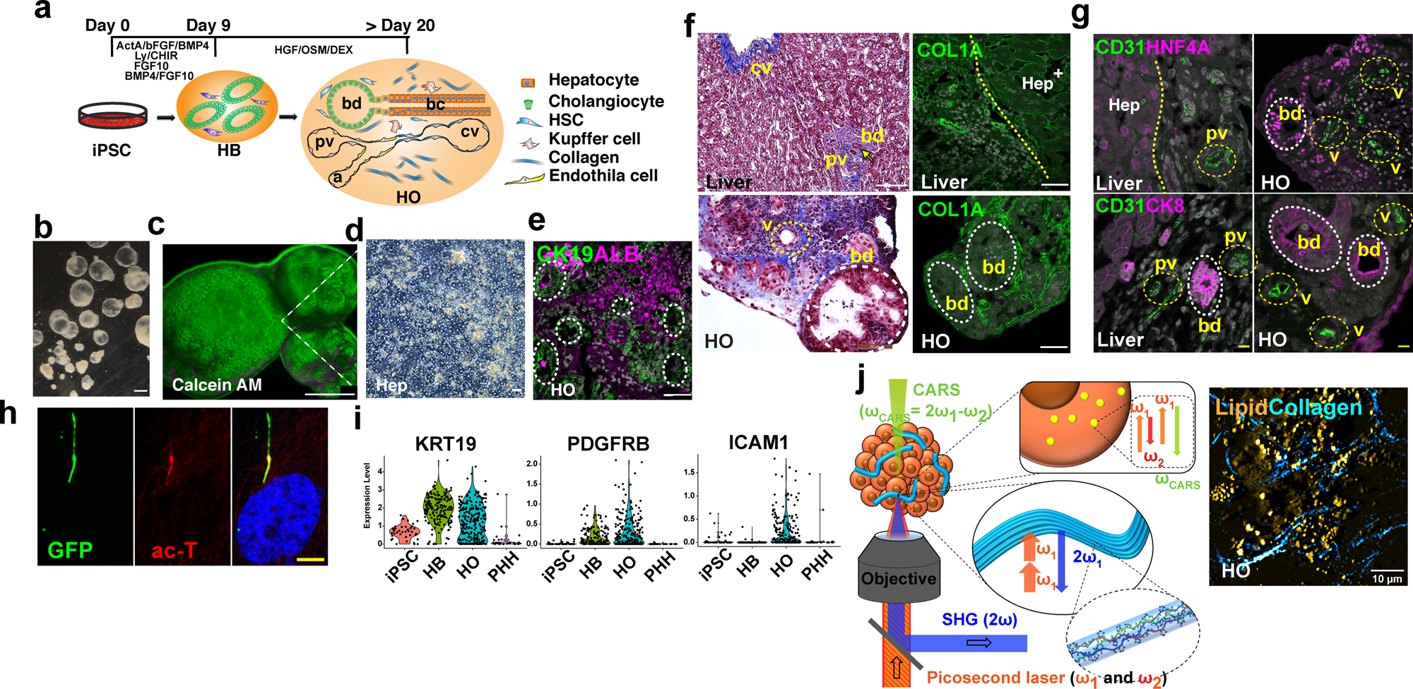 A human multi-lineage hepatic organoid model for liver fibrosis