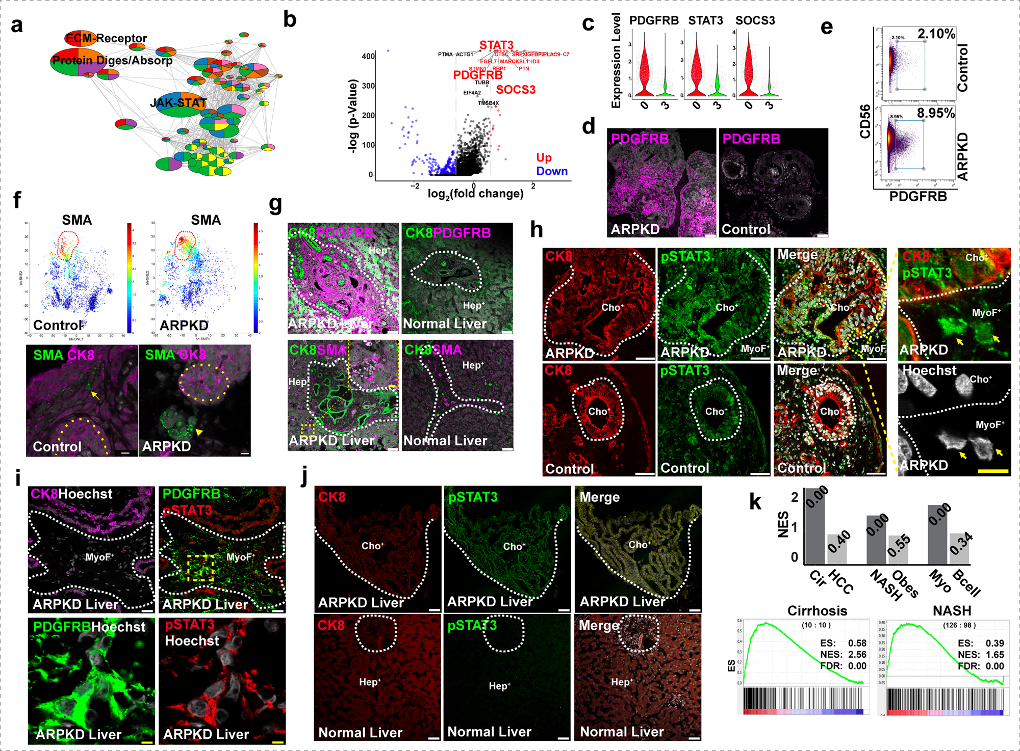 Fig. 5: ARPKD HOs have an expanded population of myofibroblasts that resemble those in fibrotic human liver tissue.