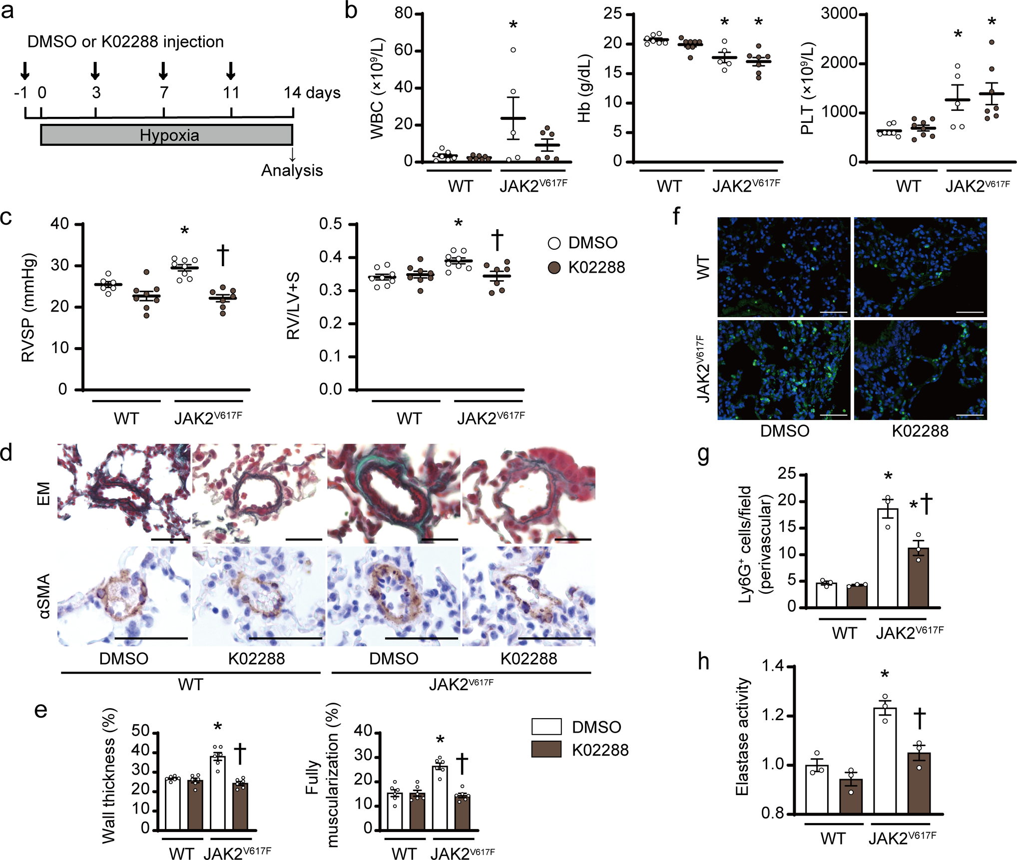 Fig. 8: Inhibition of ALK1/2 improves chronic hypoxia-induced pulmonary hypertension in JAK2V617F mice.