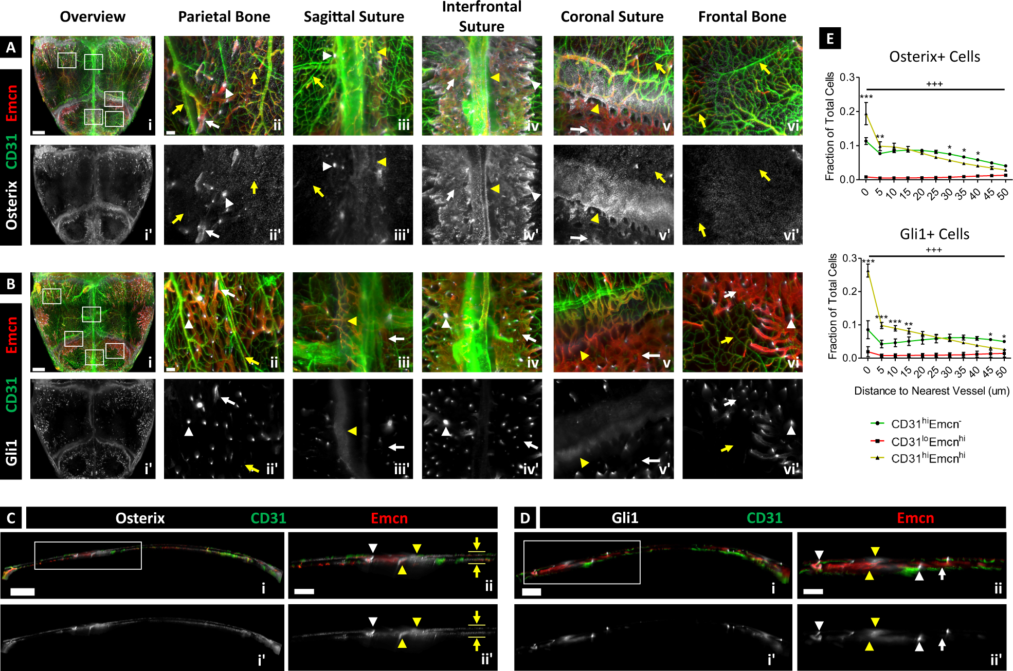 Fig. 2: 3D map of the microvascular environment in 4-weeks-old murine calvaria.