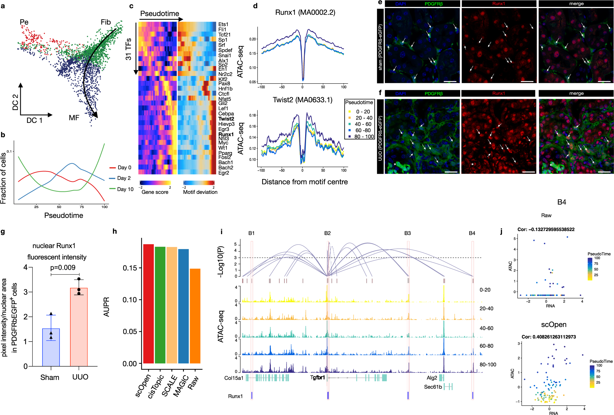Fig. 4: Role of Runx1 in myofibroblast differentiation.
