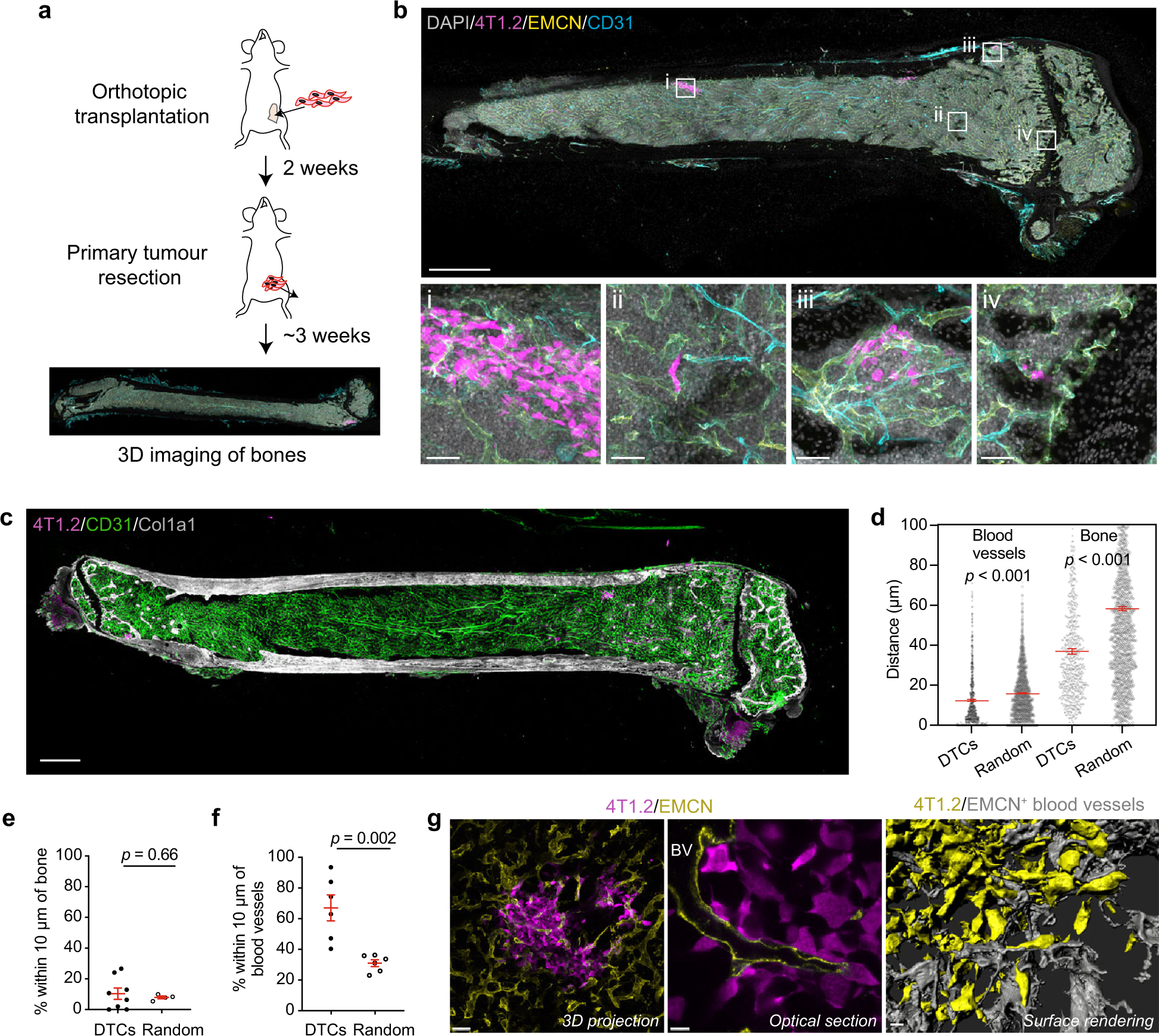 Mammary Tumour Cells Remodel The Bone Marrow Vascular Microenvironment To  Support Metastasis | Nature Communications Mammary Tumour Cells Remodel The Bone Marrow Vascular Microenvironment To  Support Metastasis | Nature Communications