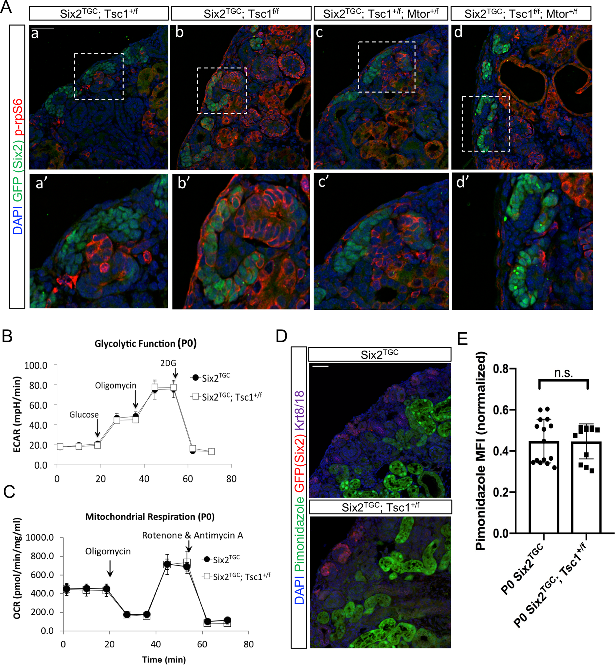 Fig. 3: Evaluation of metabolic contributions to the enhanced nephrogenic phenotype in Six2TGC;Tsc1.