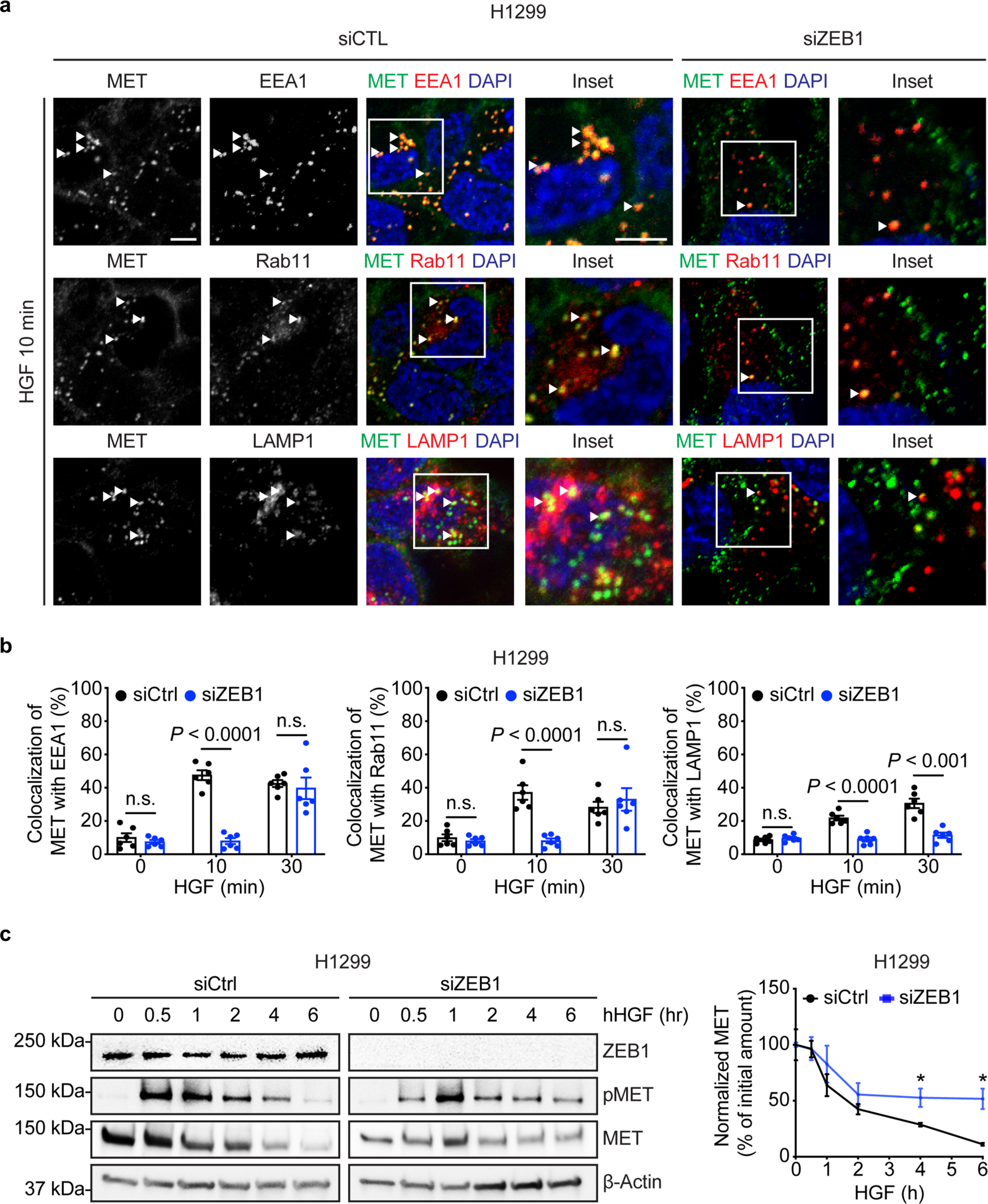 Fig. 5: ZEB1 influences intracellular trafficking of MET.