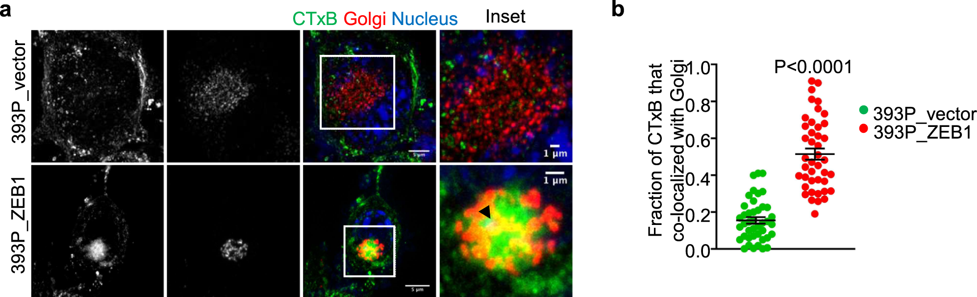 Fig. 6: ZEB1 accelerates retrograde vesicular trafficking.