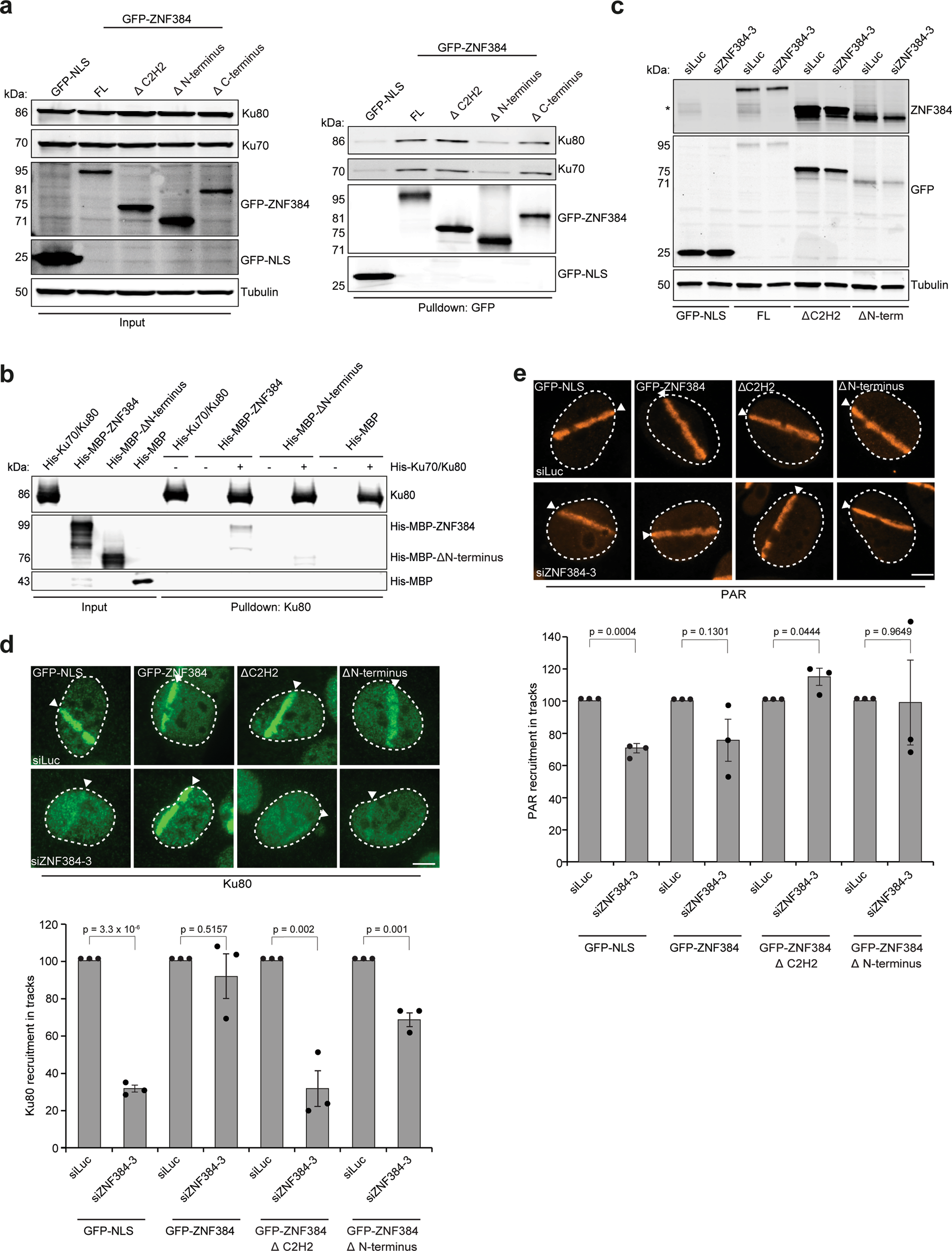 Fig. 5: The C2H2 motifs and N-terminus of ZNF384 are required for Ku70/Ku80 loading at DSBs.