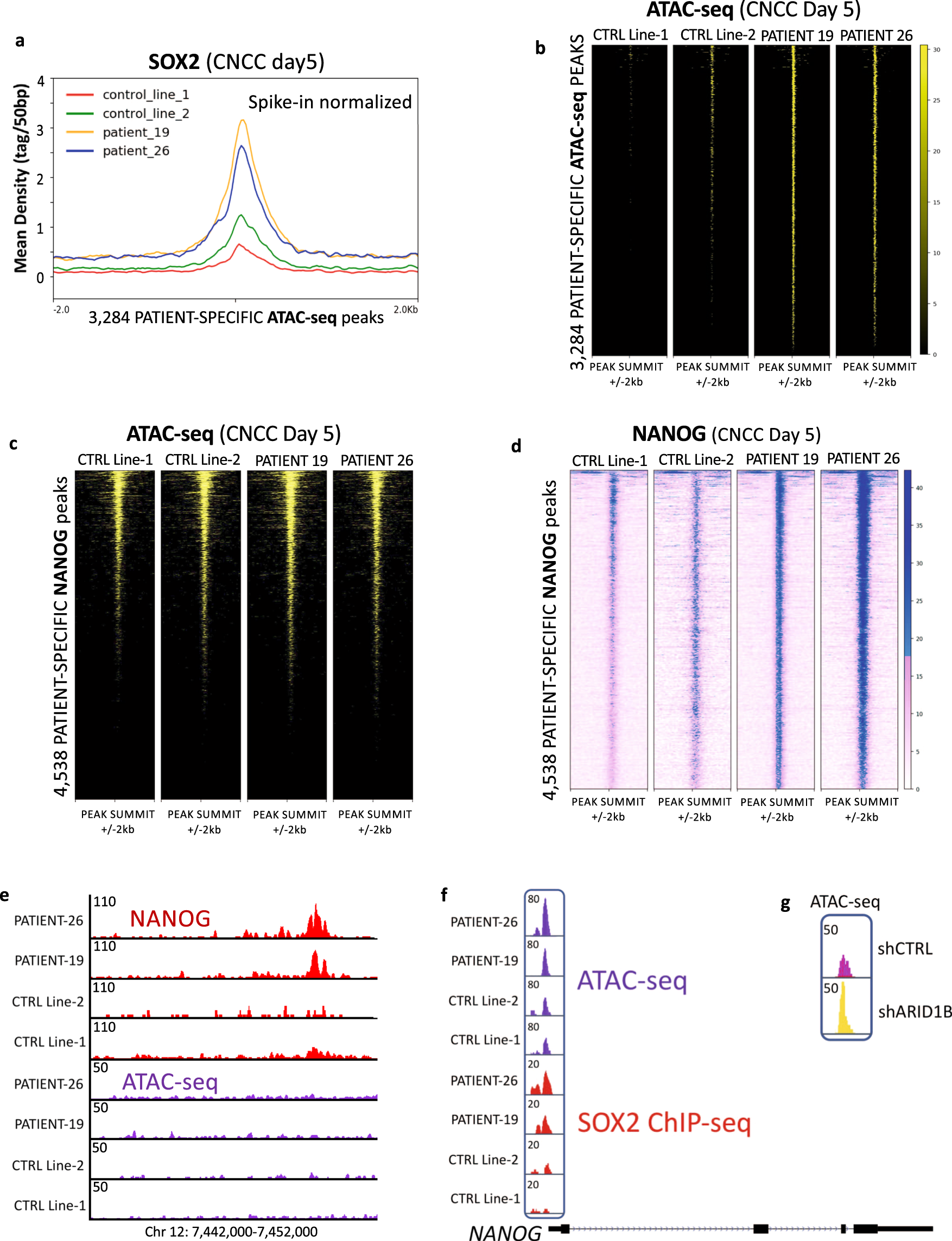 Fig. 6: Aberrant SOX2 and NANOG activity in the patient cells at CNCC day 5.