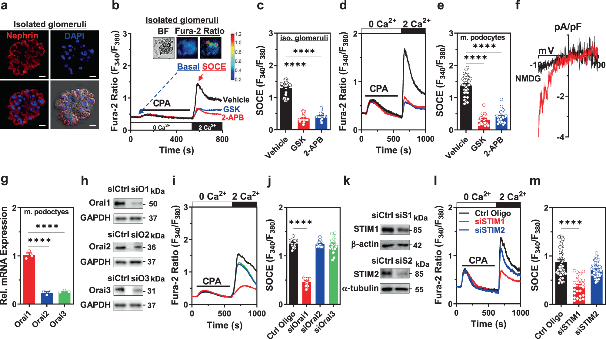 Insulin-activated store-operated Ca2+ entry via Orai1 induces podocyte  actin remodeling and causes proteinuria | Nature Communications