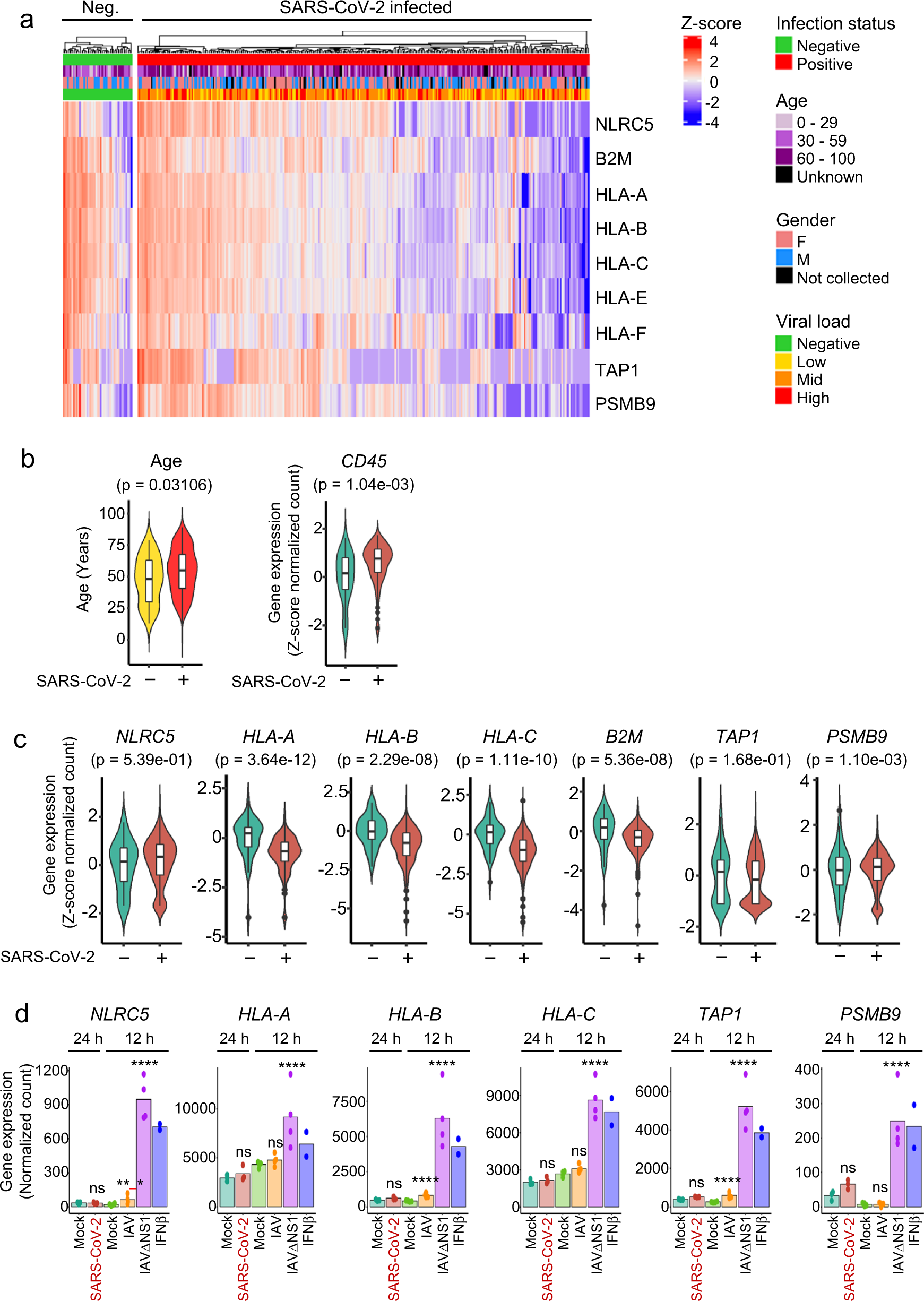 SARS-CoV-2 inhibits induction of the MHC class I pathway by targeting the  STAT1-IRF1-NLRC5 axis | Nature Communications