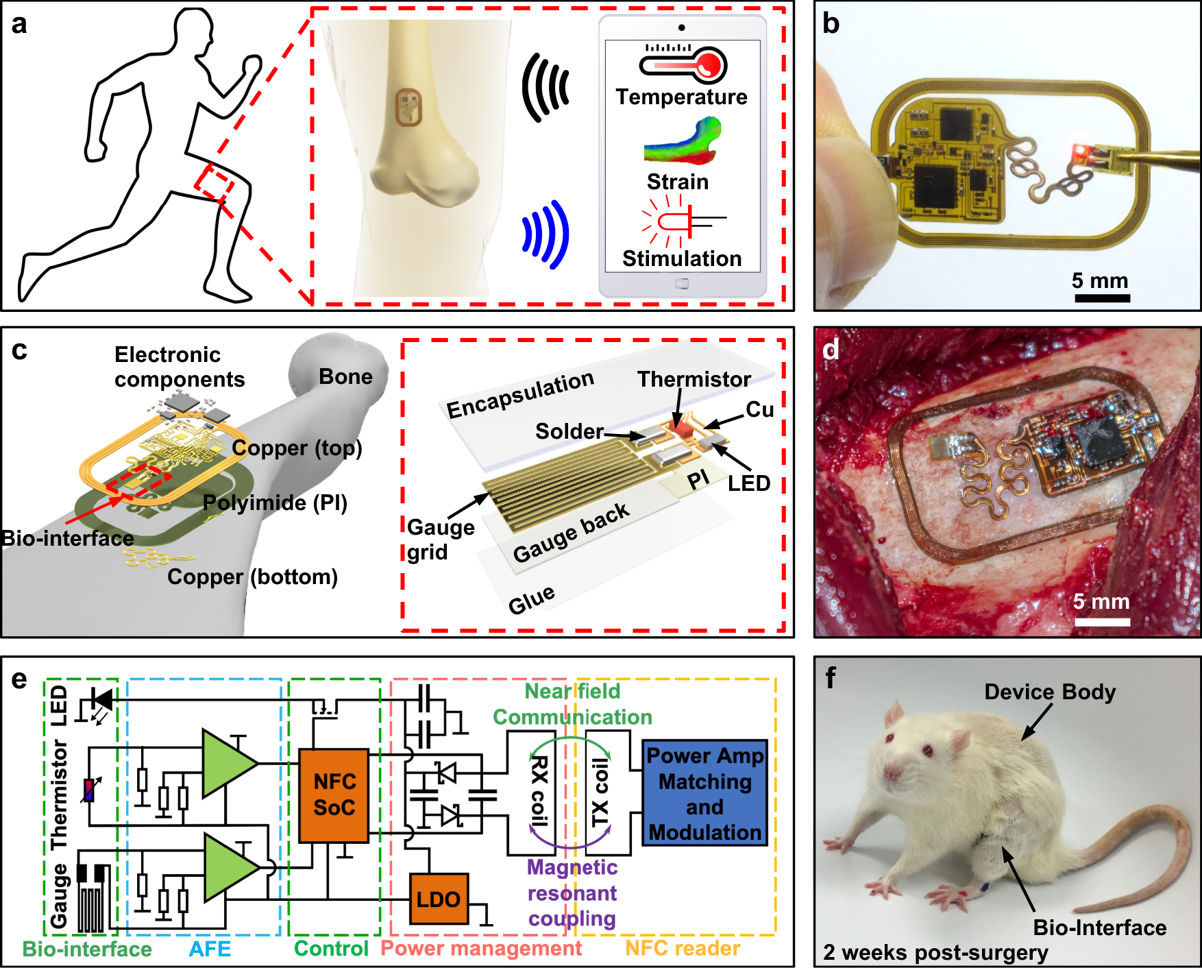 Osseosurface electronics—thin, wireless, battery-free and multimodal  musculoskeletal biointerfaces | Nature Communications