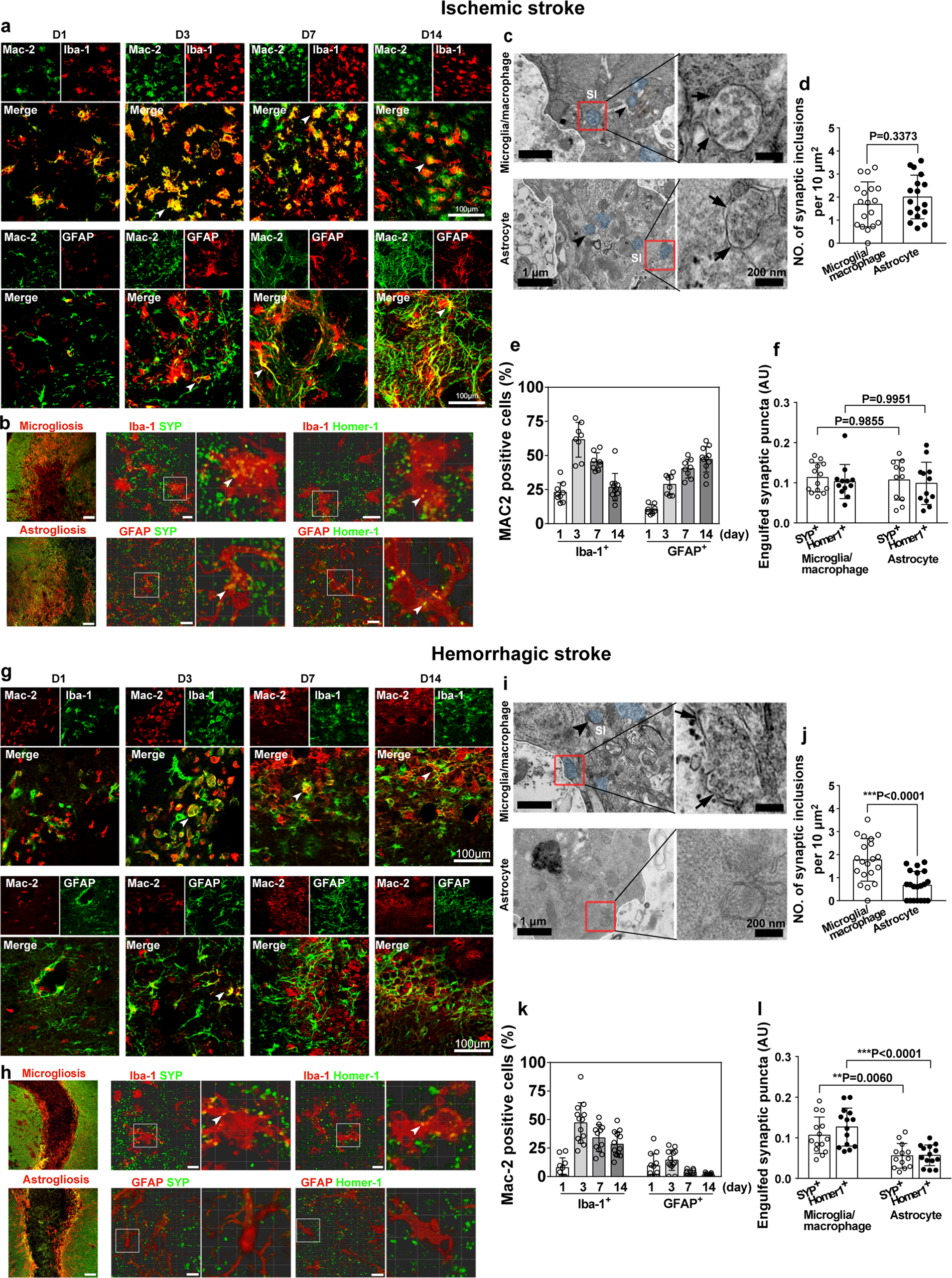 Stroke subtype-dependent synapse elimination by reactive gliosis in mice