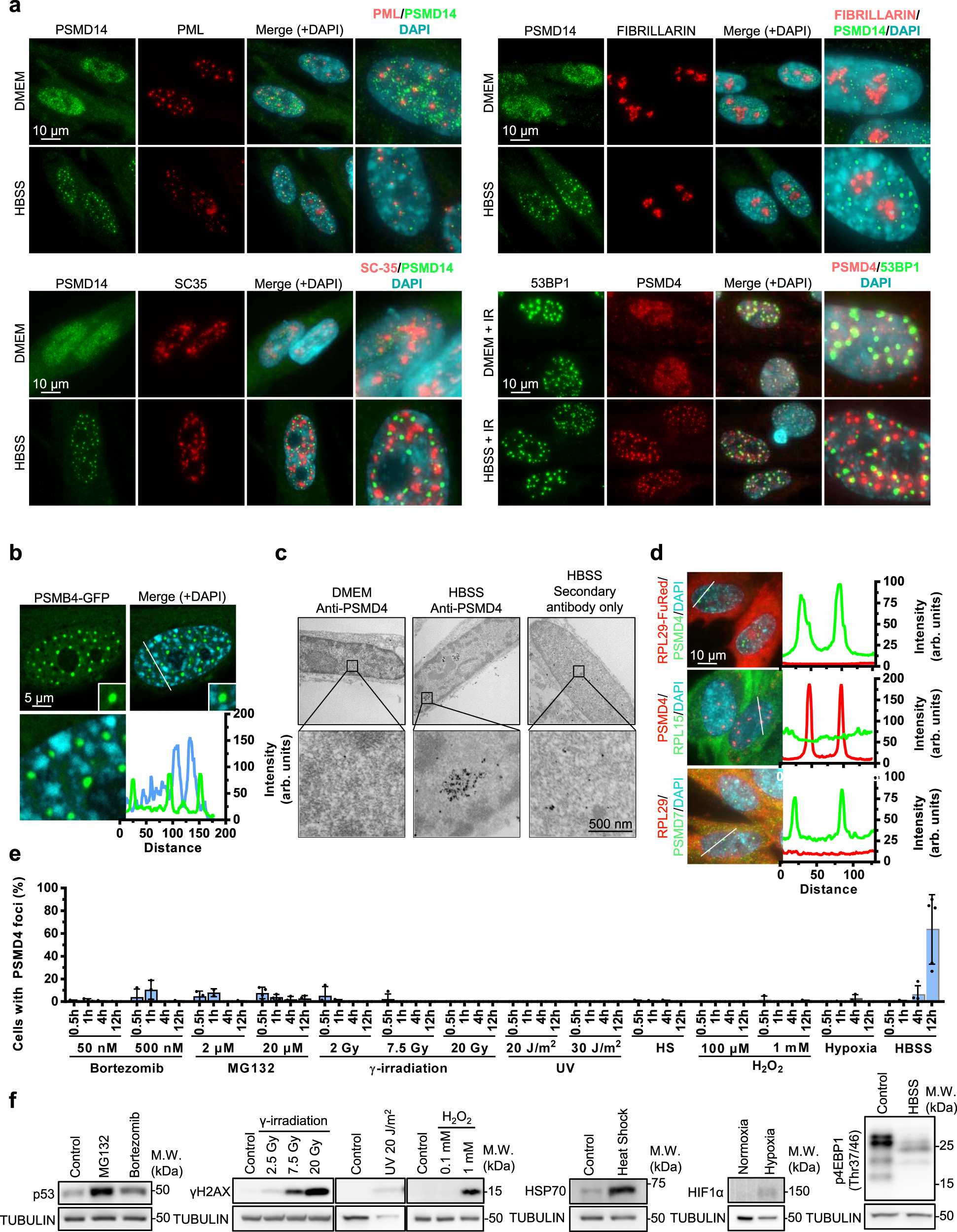 Fig. 3: SIPAN are induced by metabolic stress and do not correspond to previously known nuclear structures.